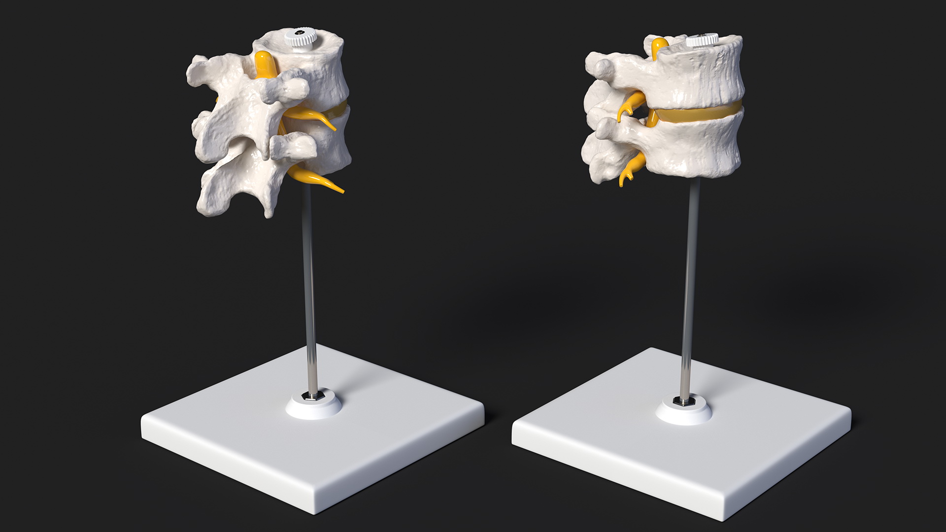 Stand with Herniated Spinal Vertebrae 3D