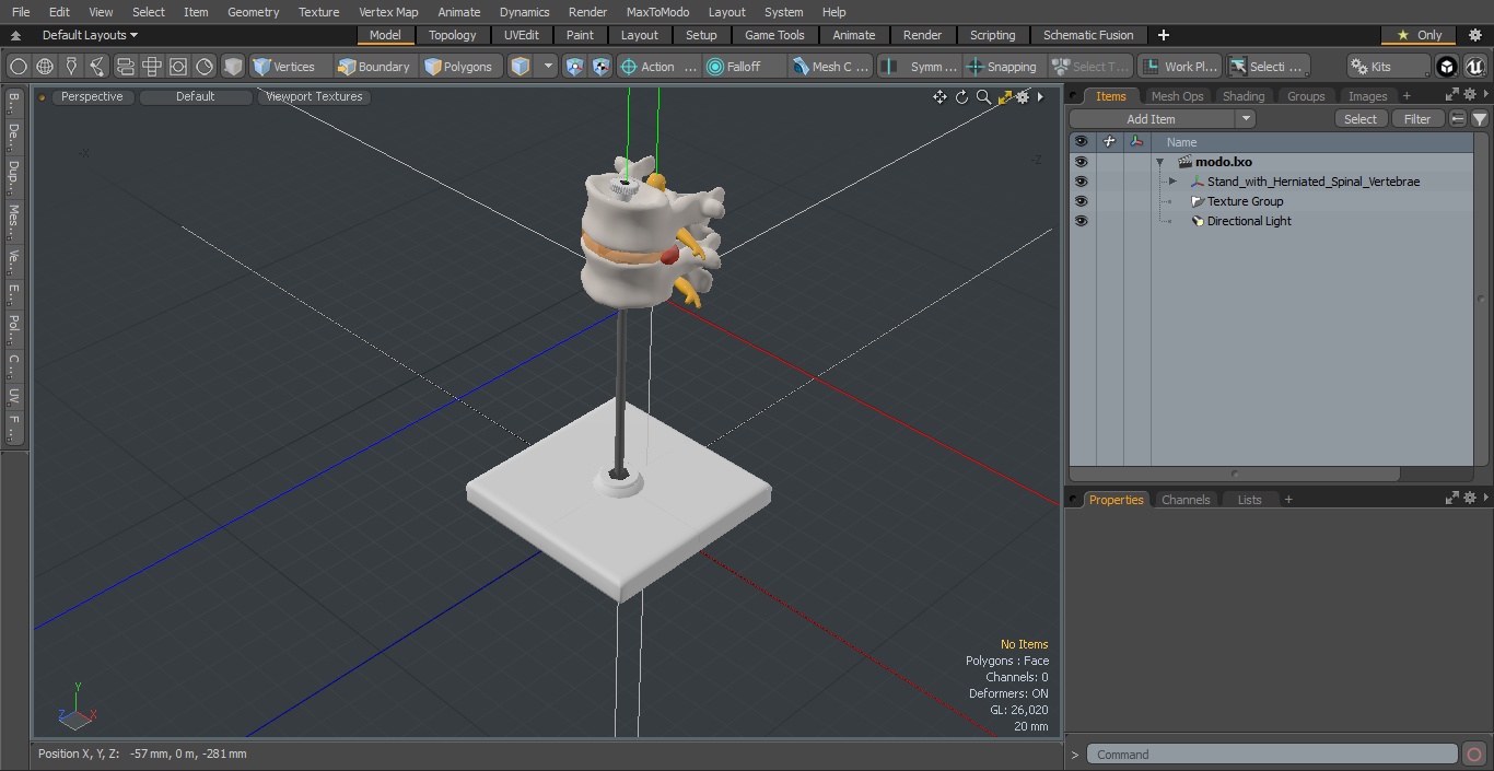Stand with Herniated Spinal Vertebrae 3D