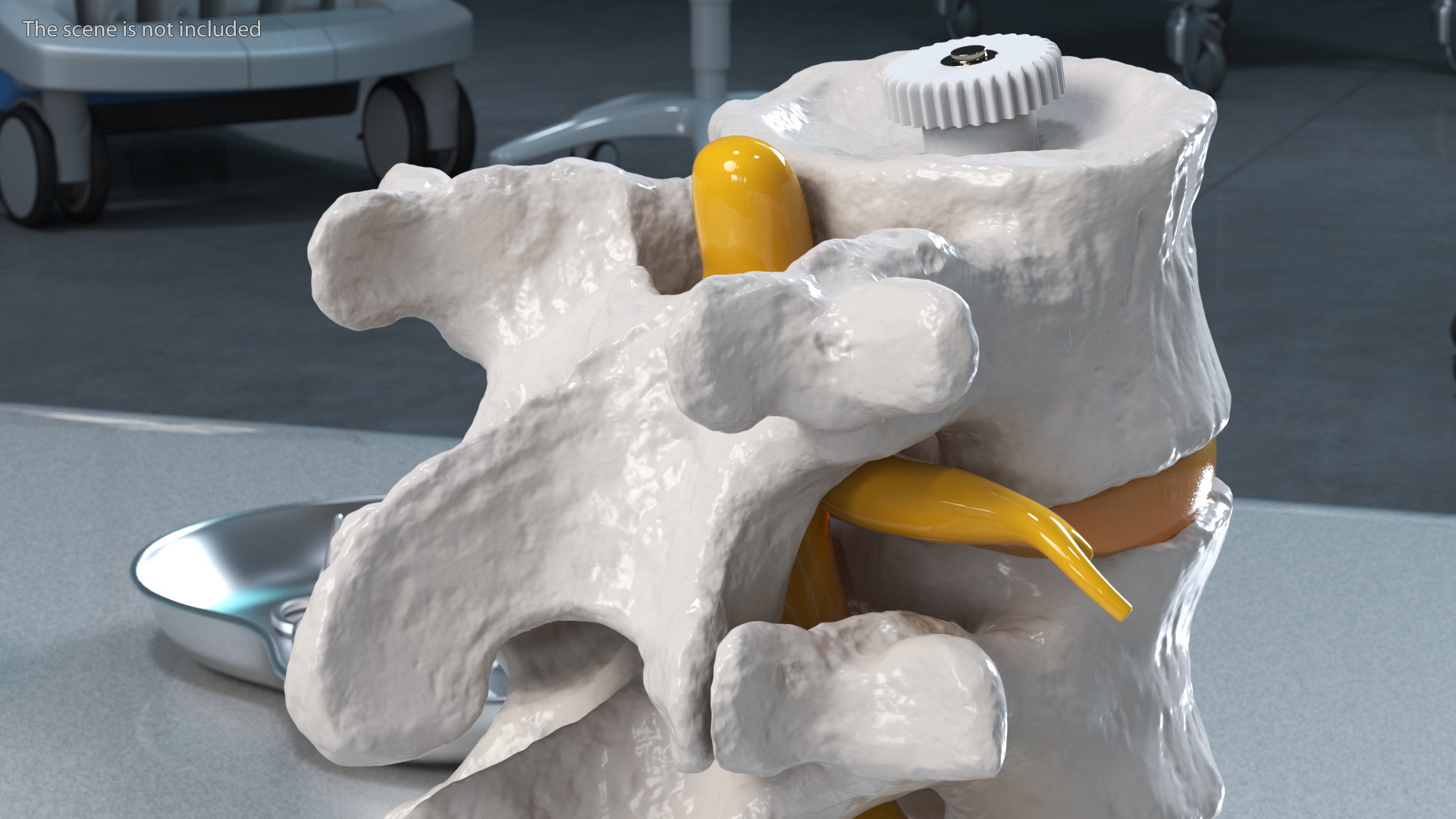 Stand with Herniated Spinal Vertebrae 3D