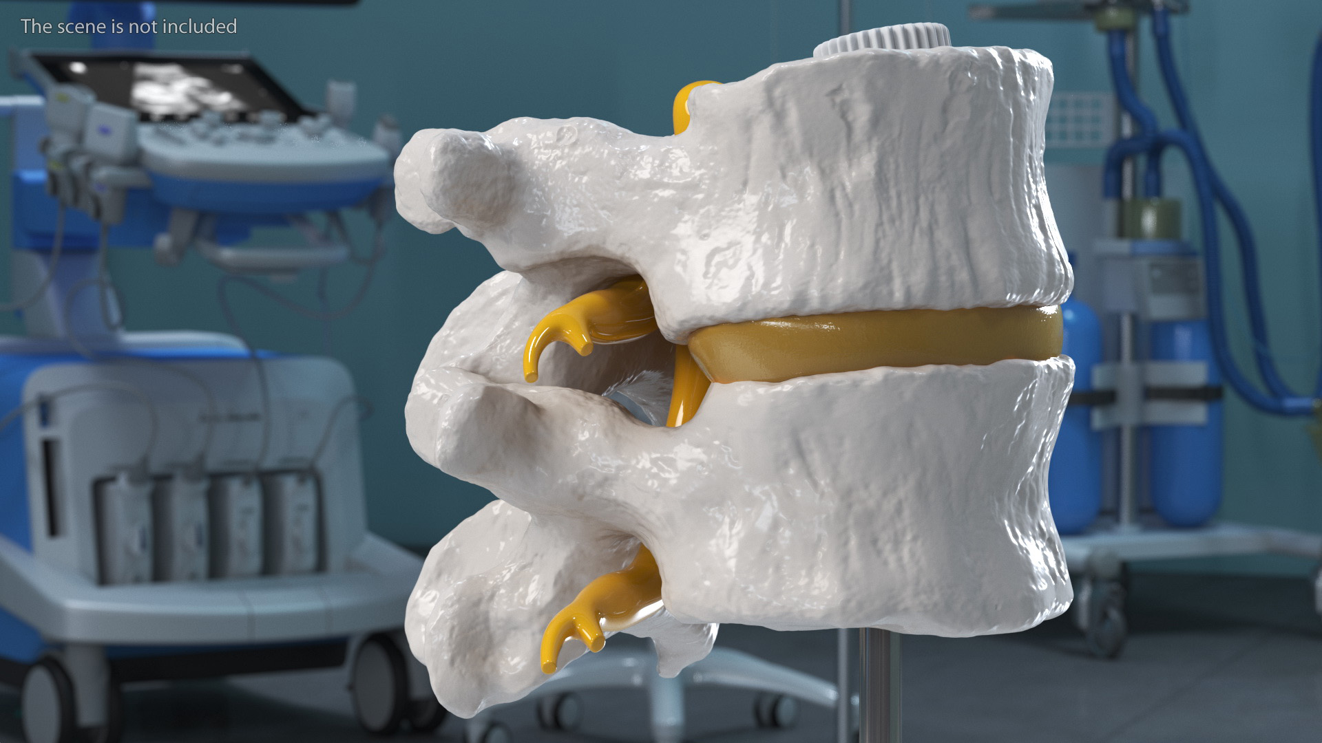 Stand with Herniated Spinal Vertebrae 3D