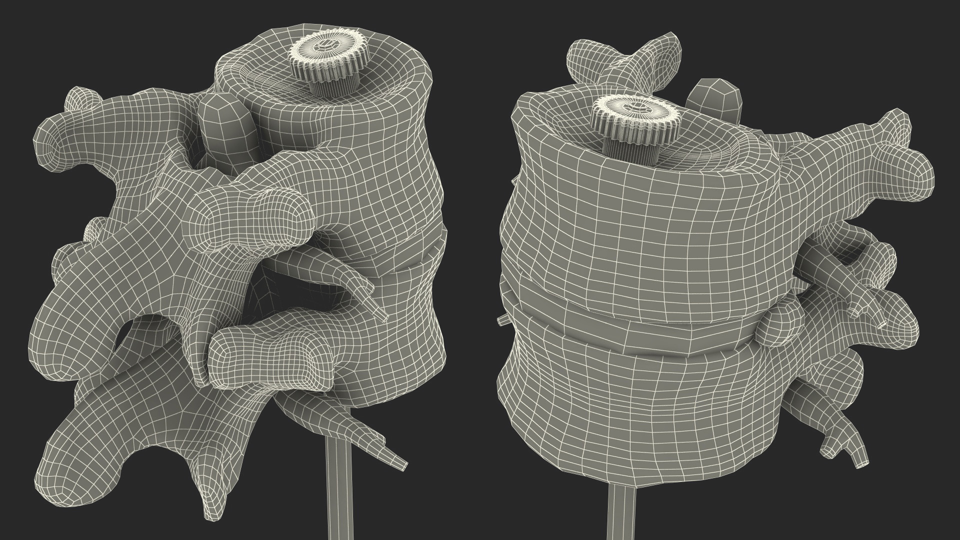 Stand with Herniated Spinal Vertebrae 3D