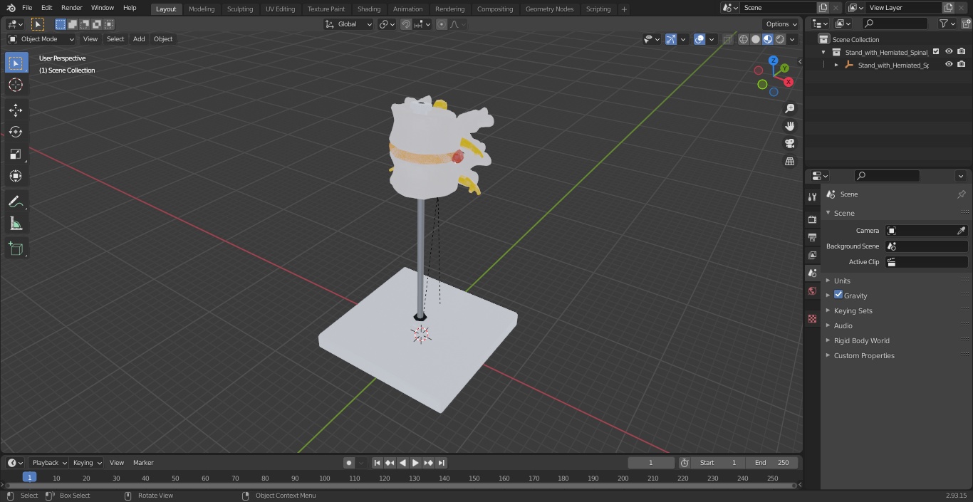 Stand with Herniated Spinal Vertebrae 3D