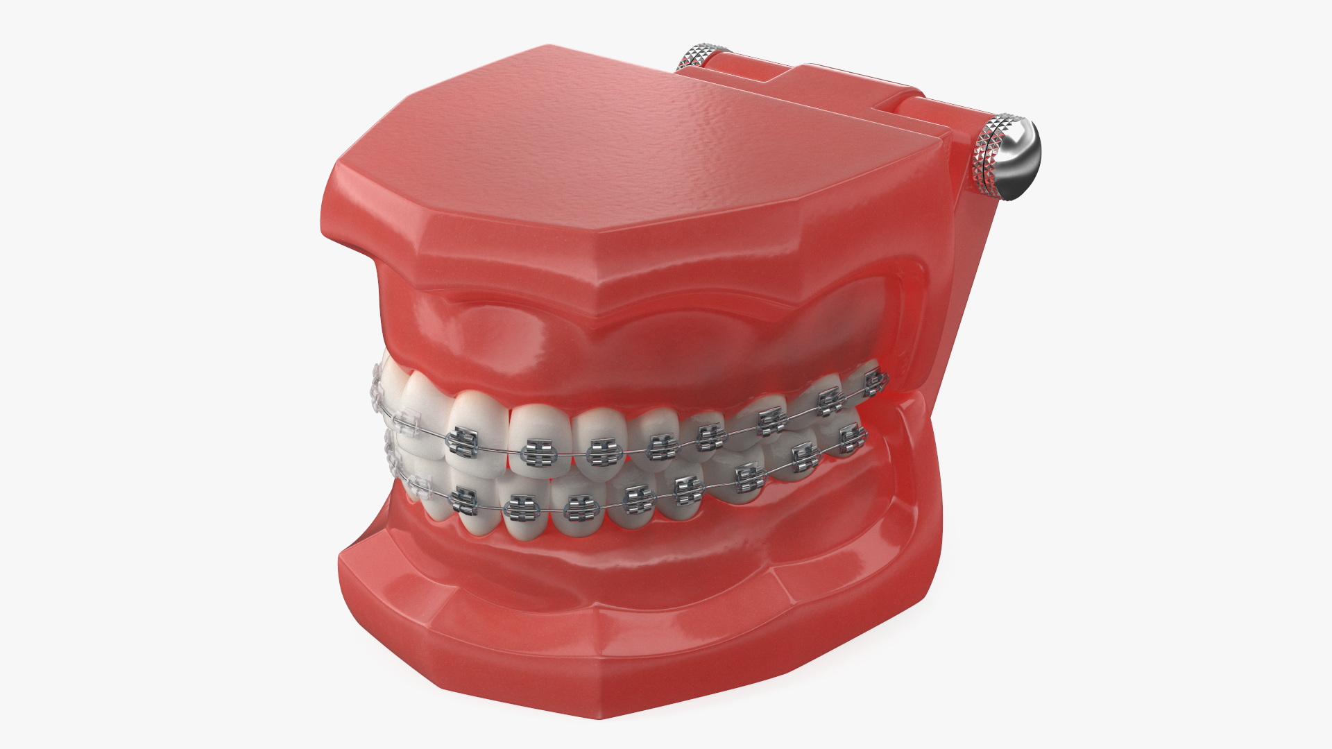 3D model Ligature Braces on Teeth Model