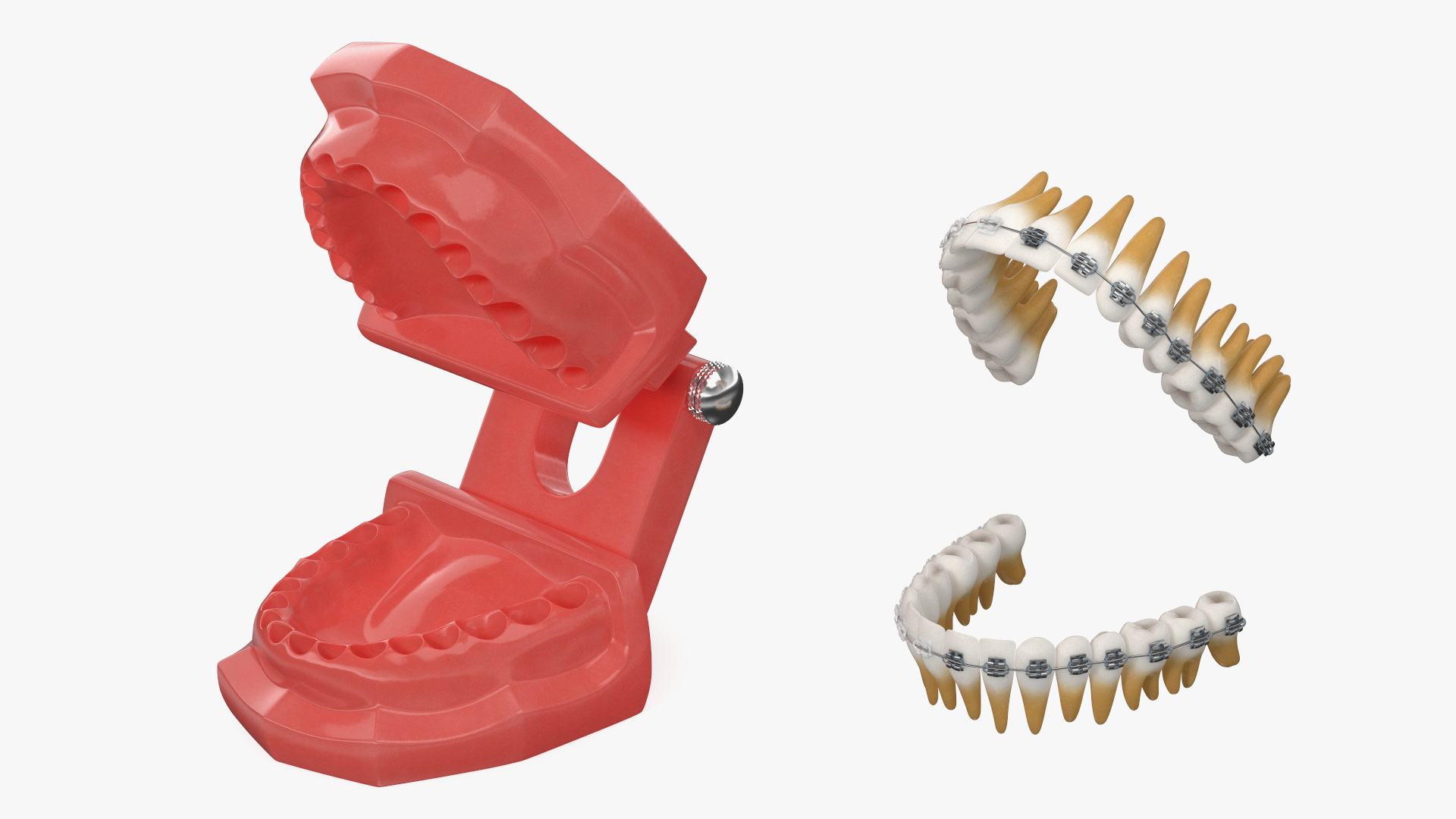 3D model Ligature Braces on Teeth Model