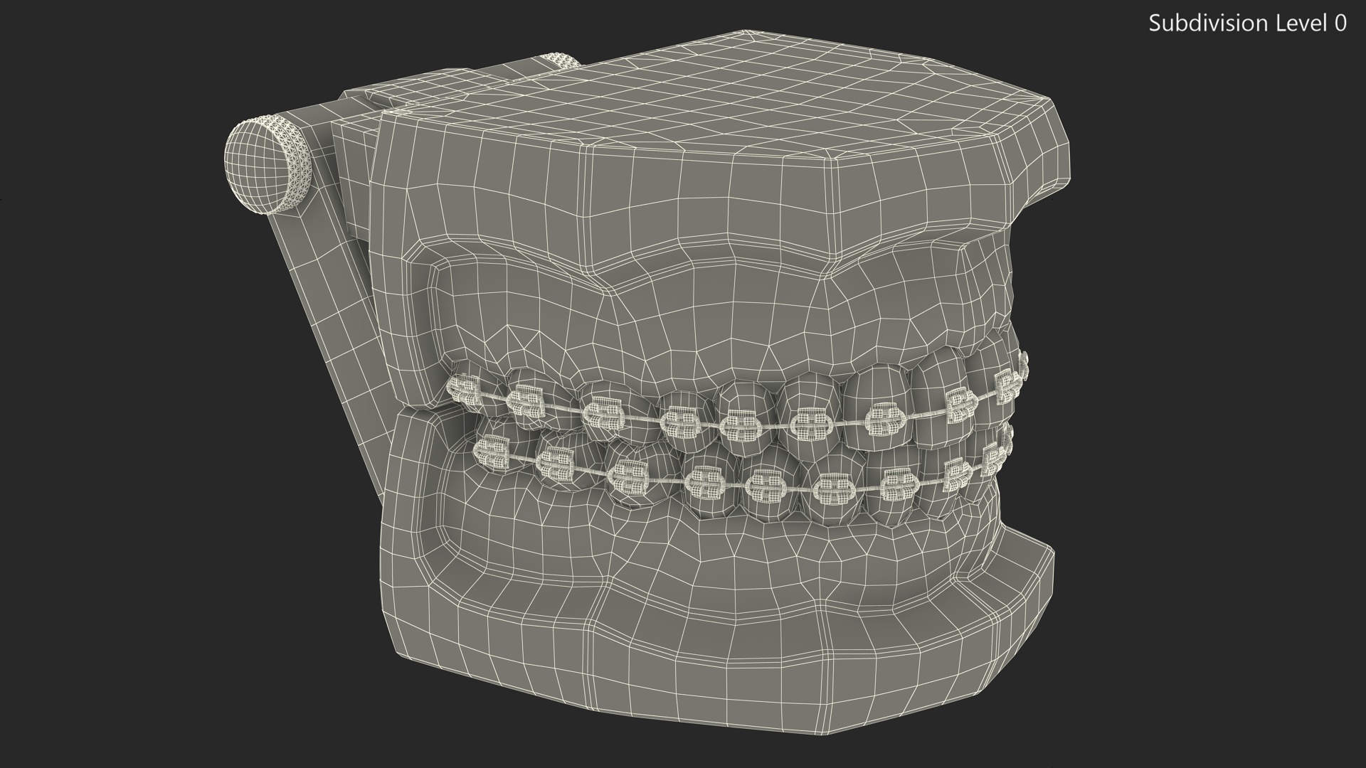 3D model Ligature Braces on Teeth Model