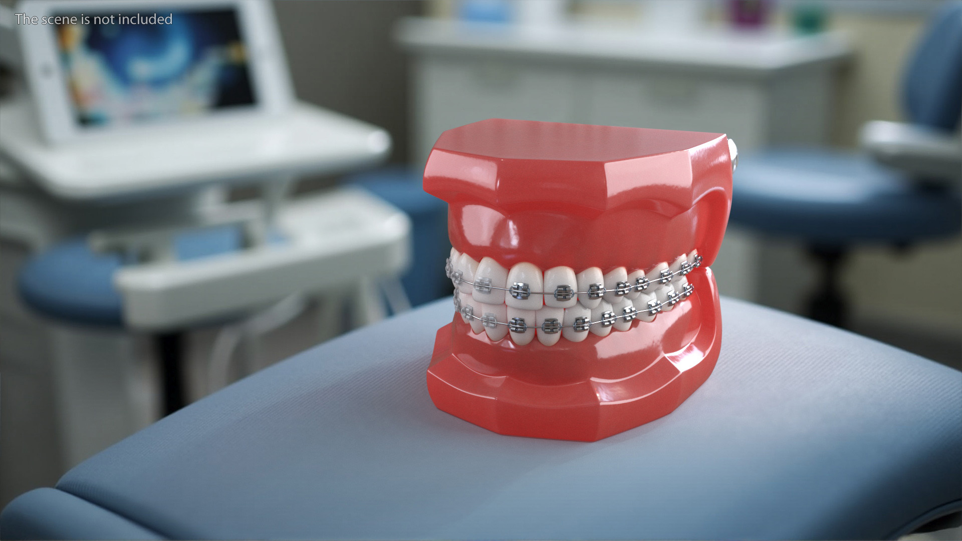 3D model Ligature Braces on Teeth Model