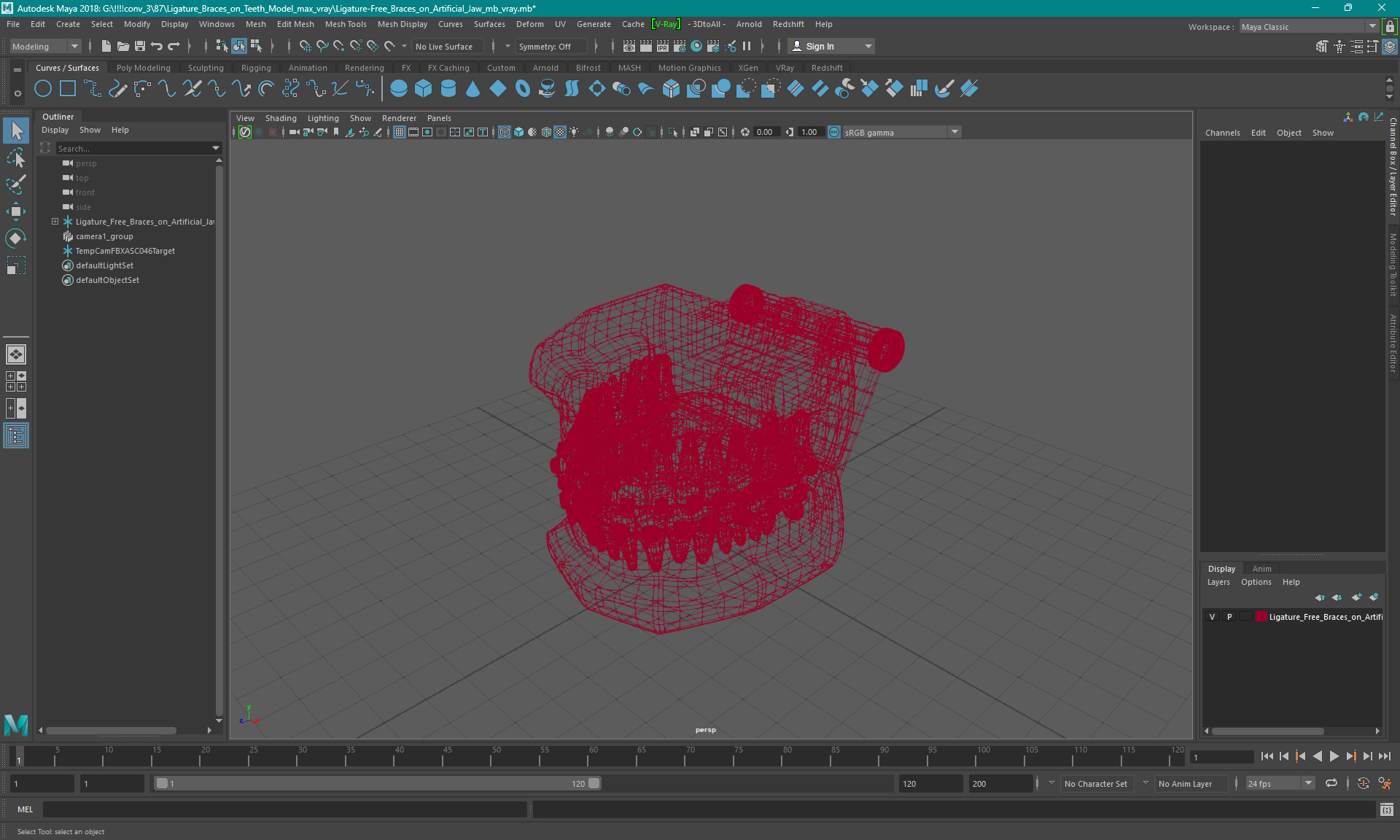 3D model Ligature Braces on Teeth Model