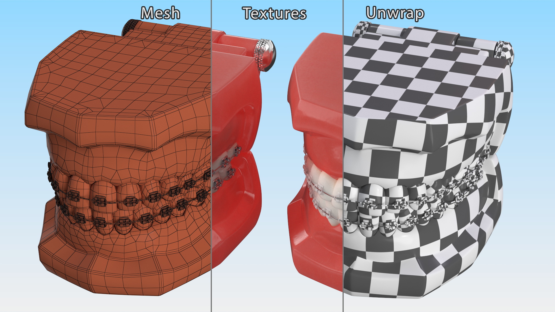 3D model Ligature Braces on Teeth Model