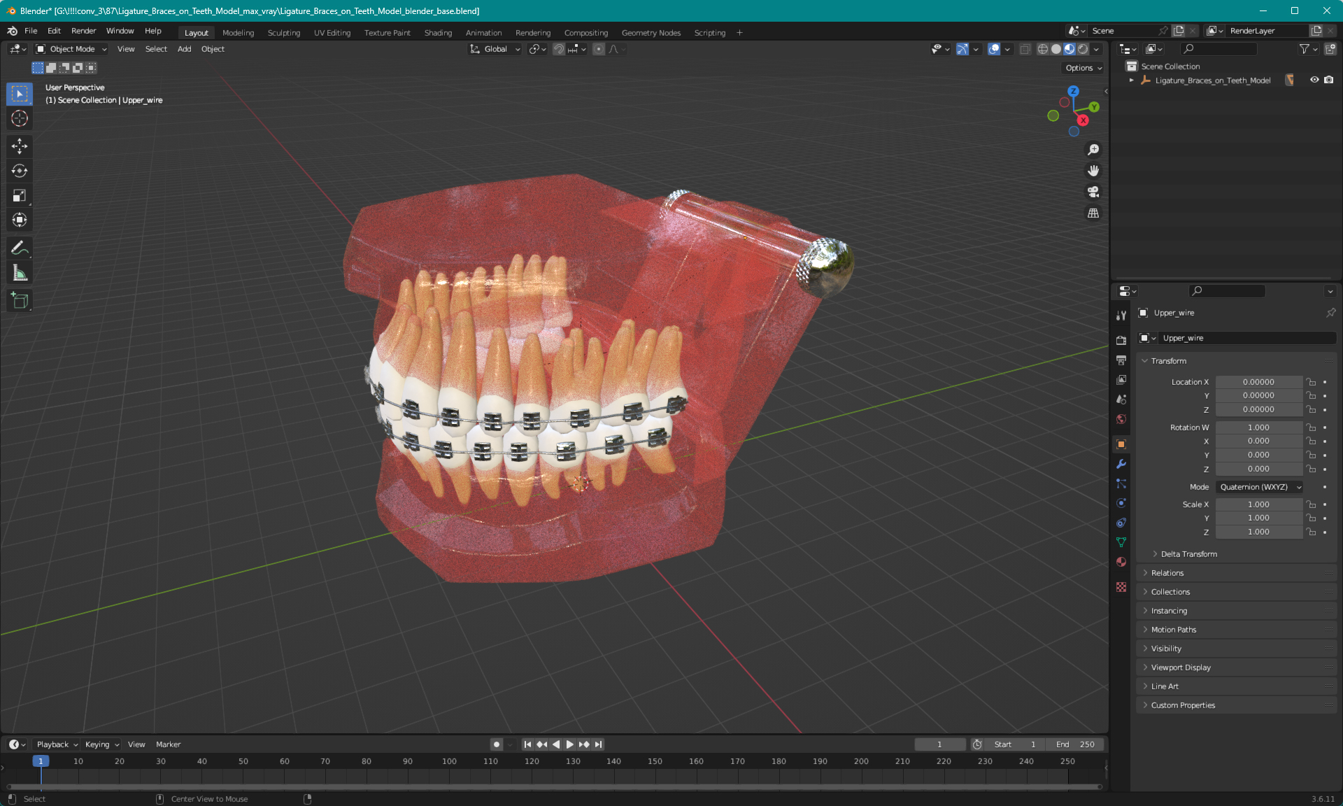 3D model Ligature Braces on Teeth Model