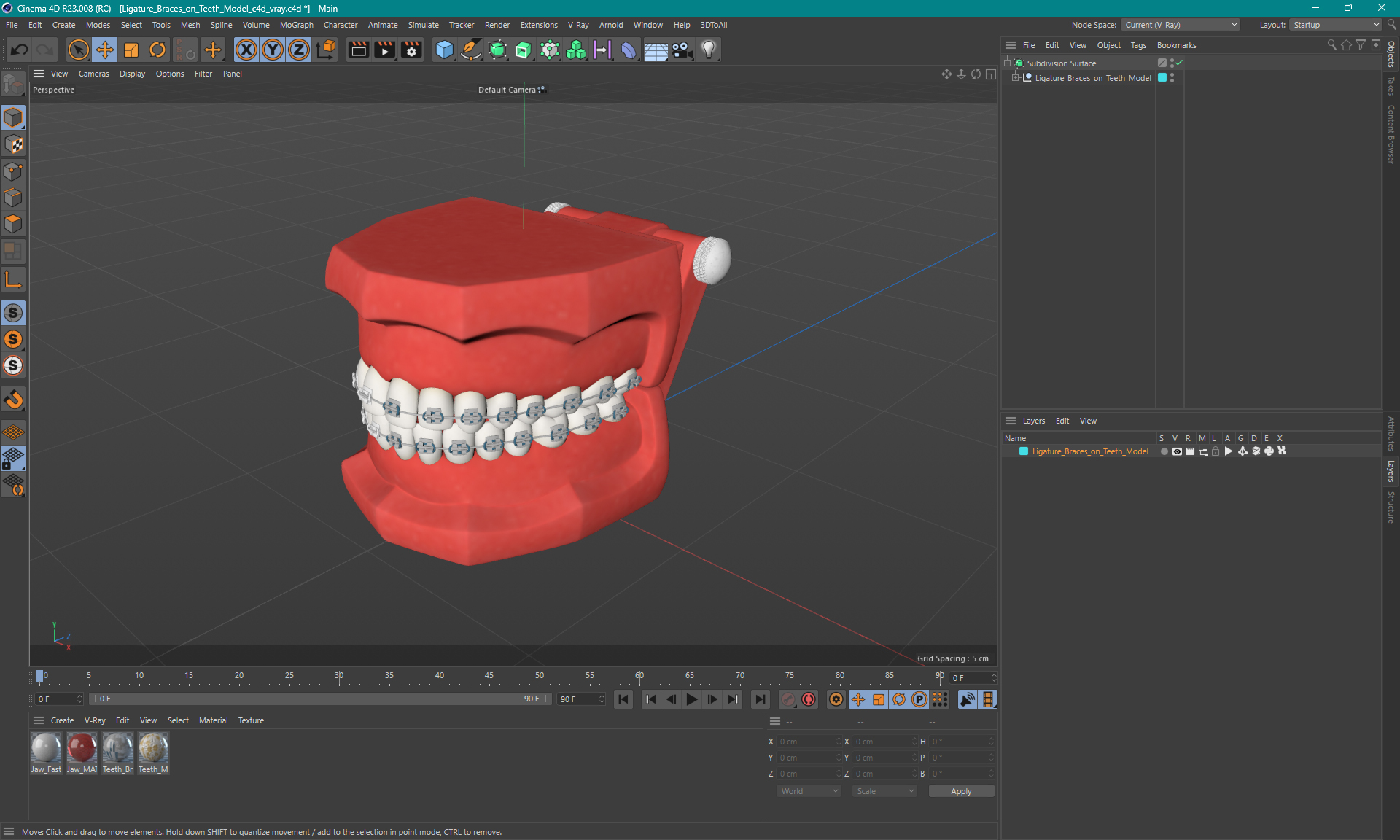 3D model Ligature Braces on Teeth Model