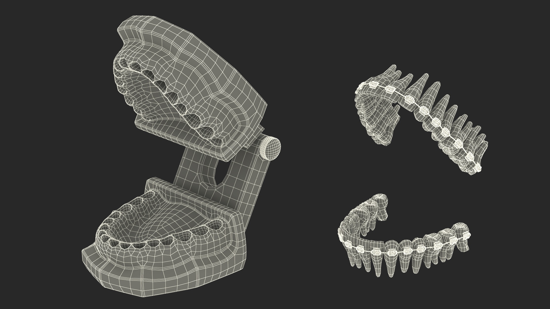 3D model Ligature Braces on Teeth Model