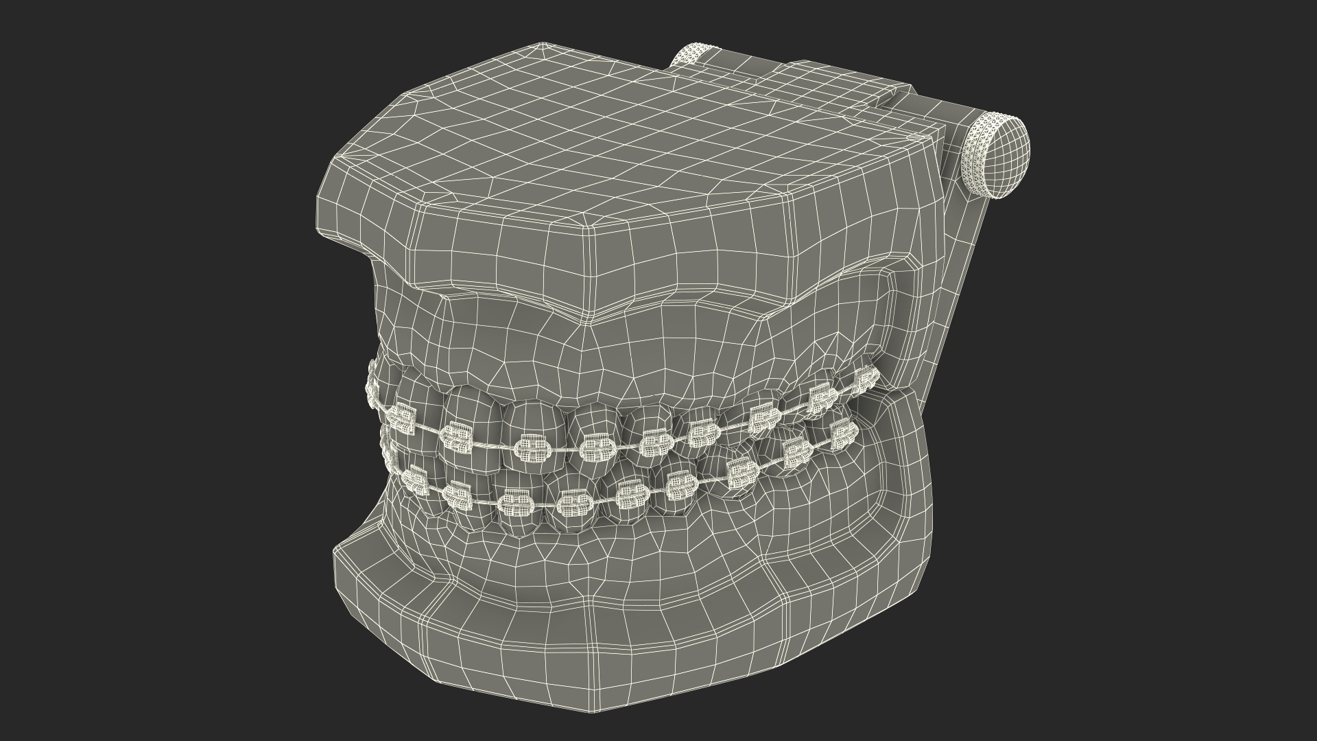 3D model Ligature Braces on Teeth Model