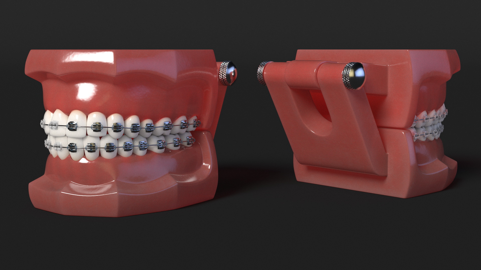 3D model Ligature Braces on Teeth Model