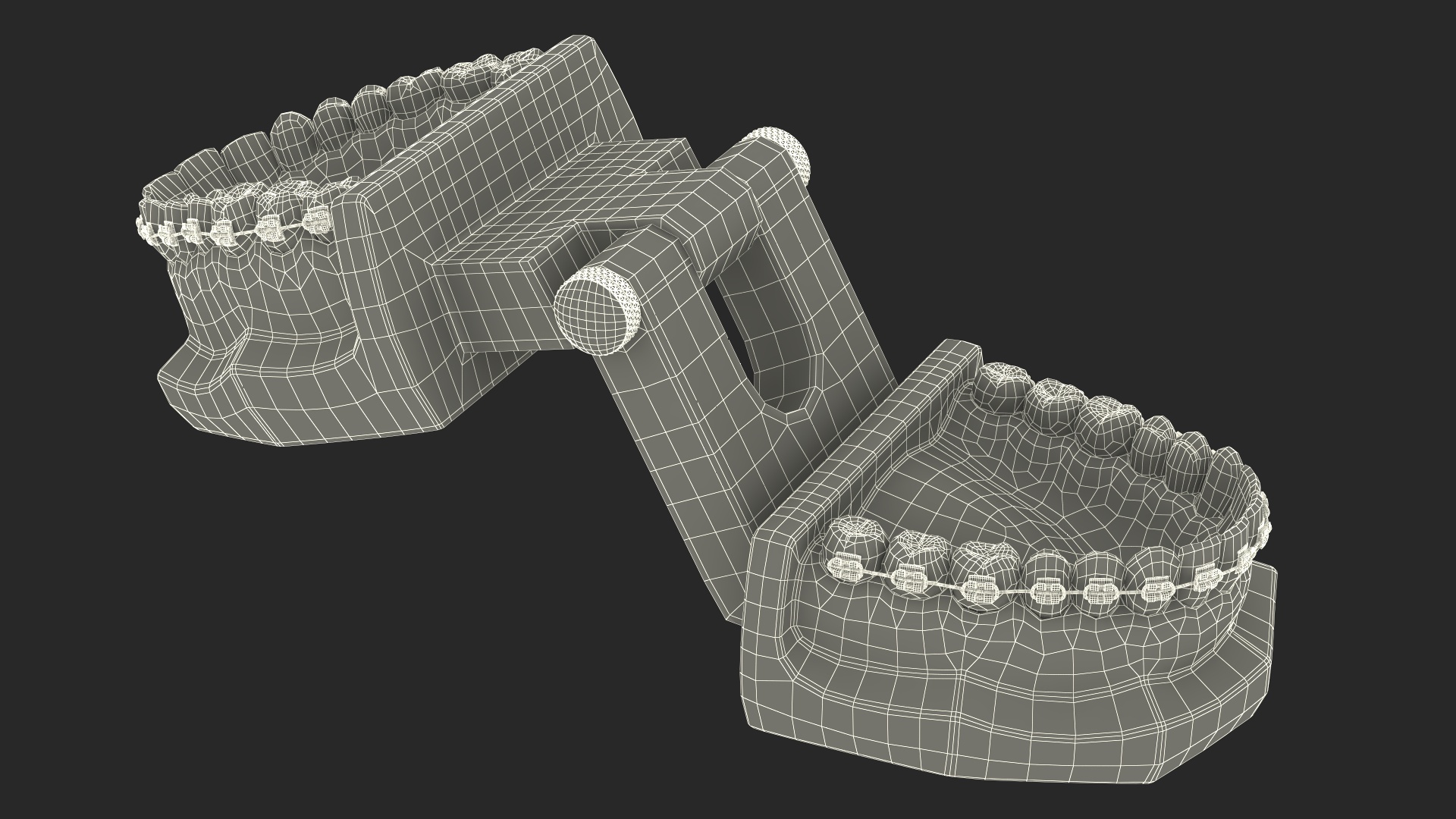 3D model Ligature Braces on Teeth Model