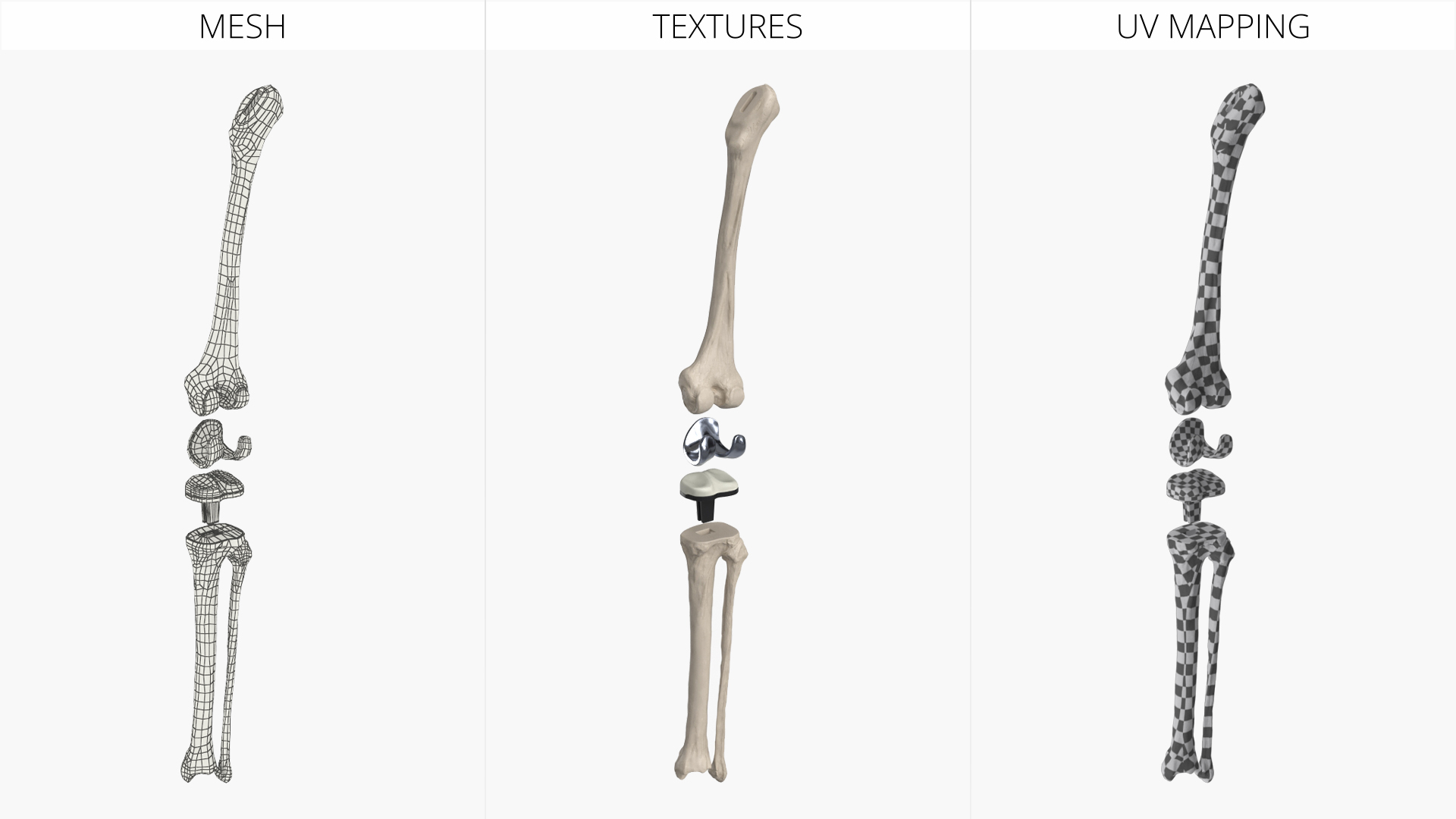 Knee Joint Implant with Femur Tibia and Fibula, view 7