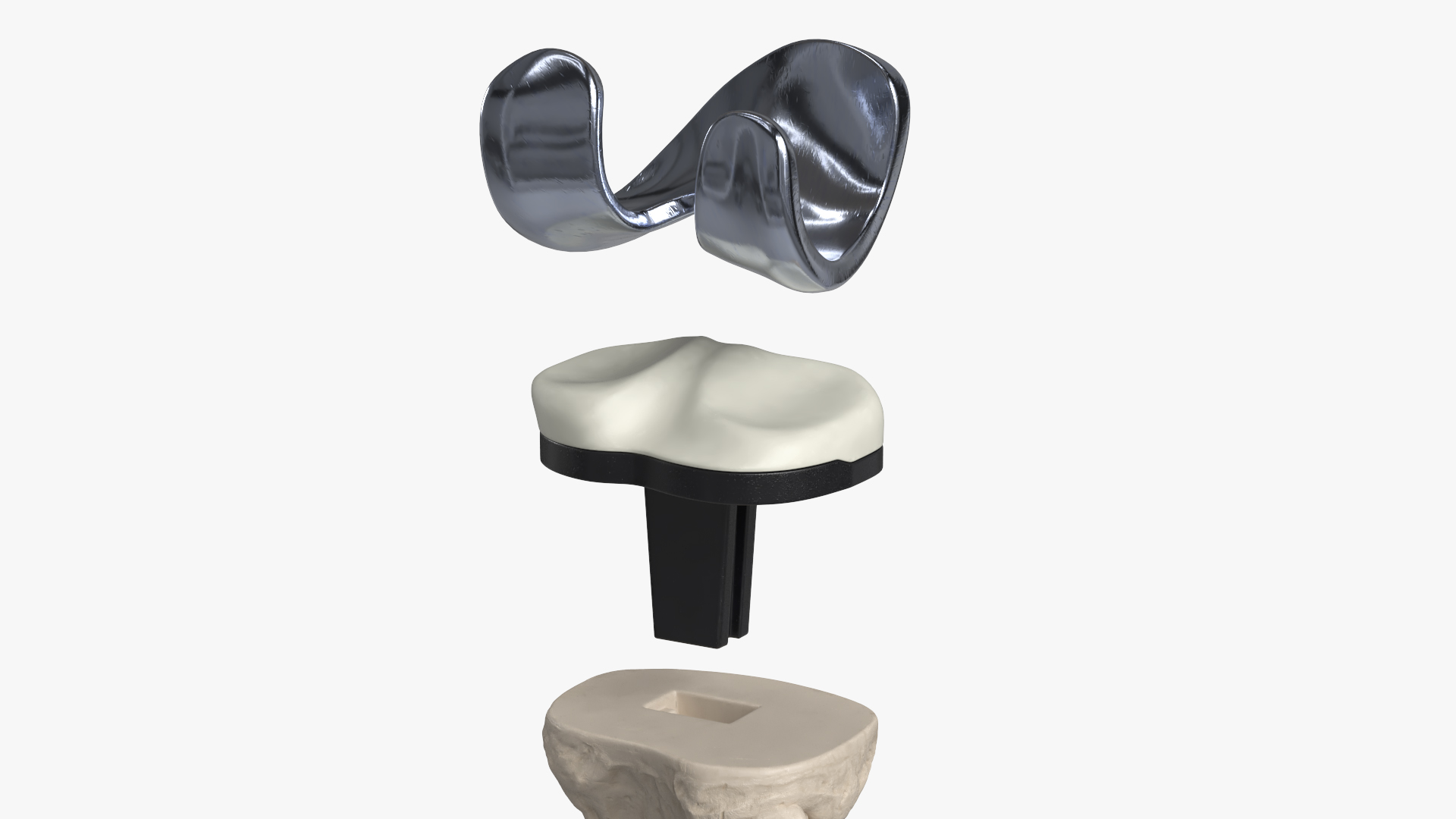 Knee Joint Implant with Femur Tibia and Fibula, view 6