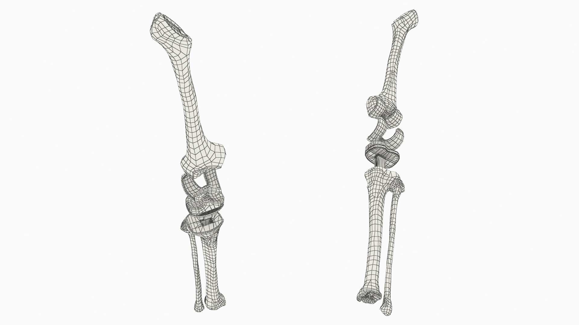 Knee Joint Implant with Femur Tibia and Fibula, view 10