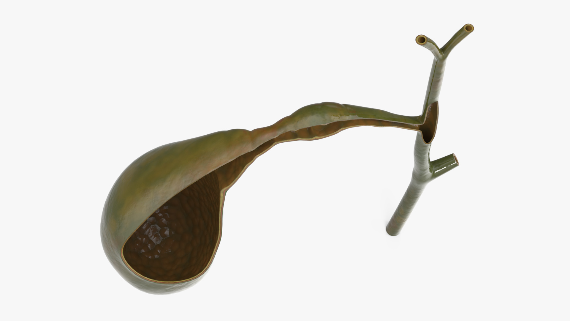 3D Gall Bladder Cut