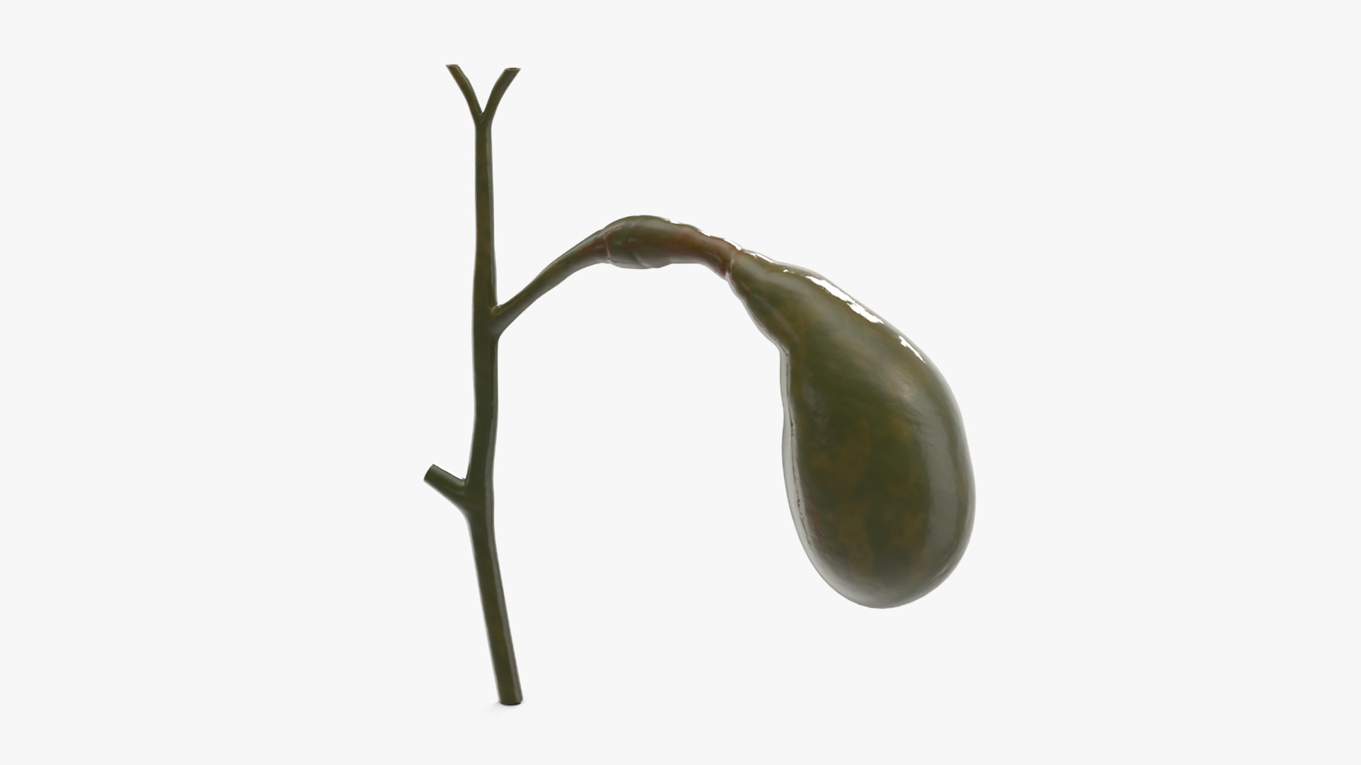 3D Gall Bladder Cut