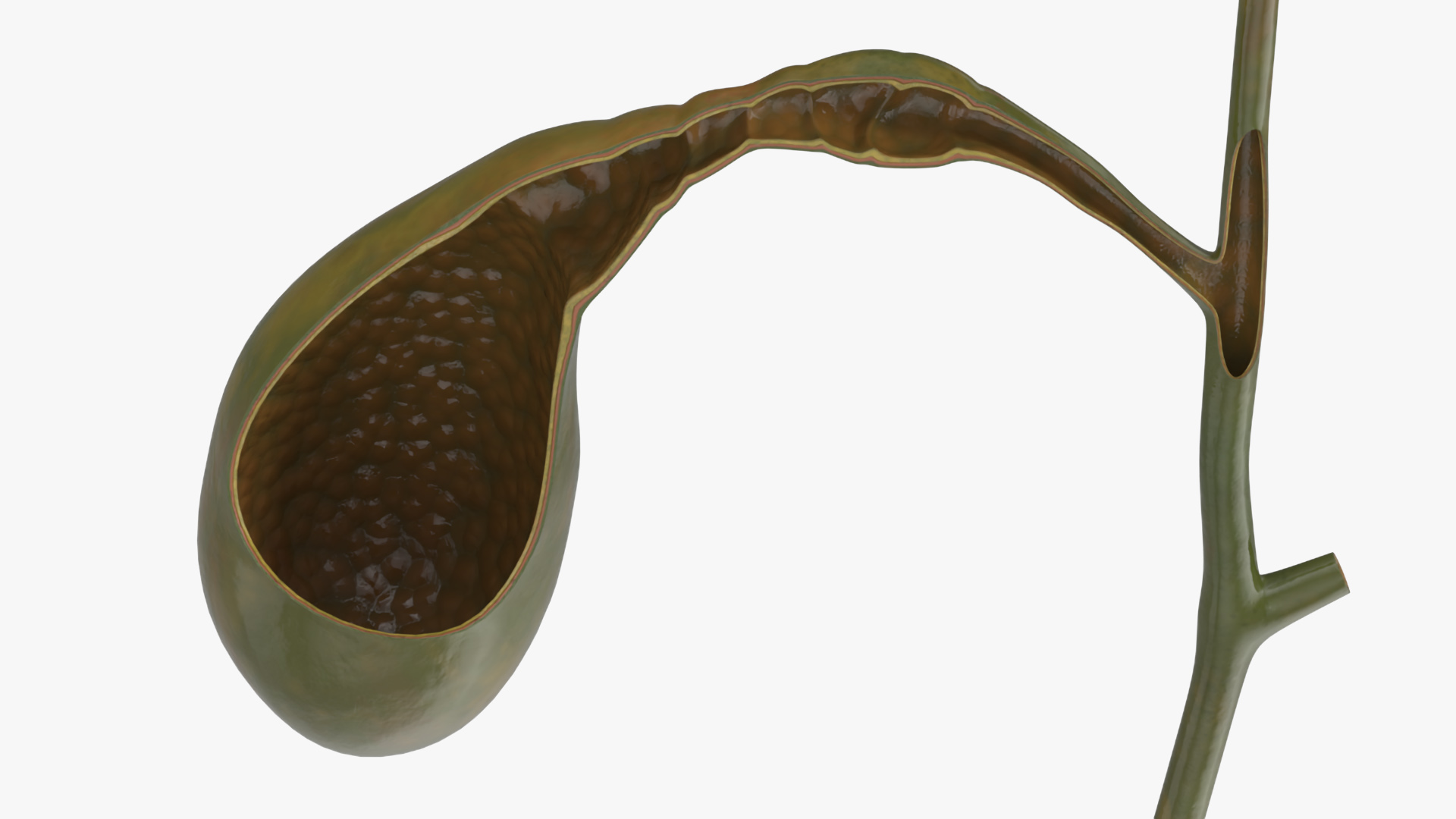 3D Gall Bladder Cut