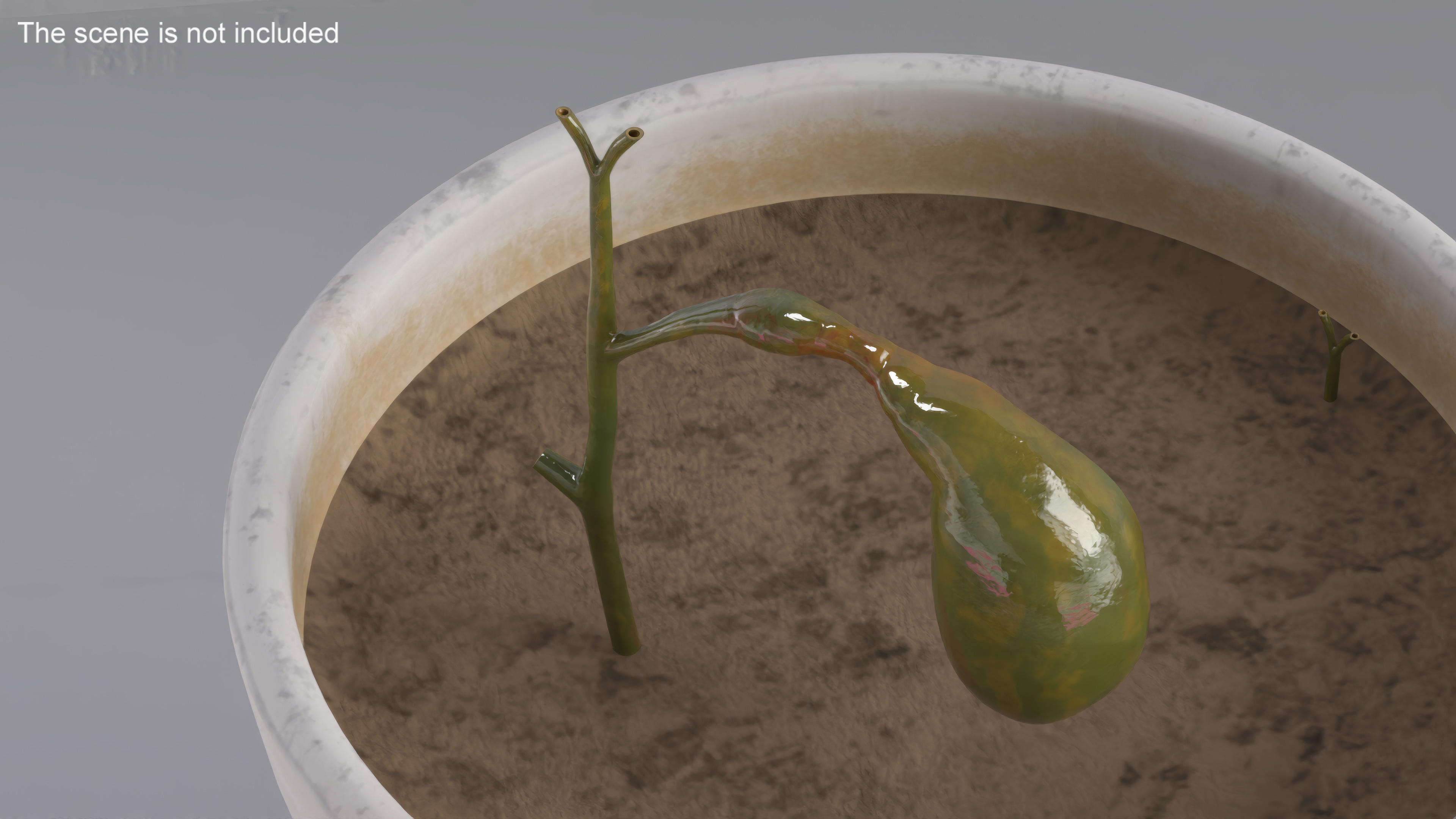 3D Gall Bladder Cut