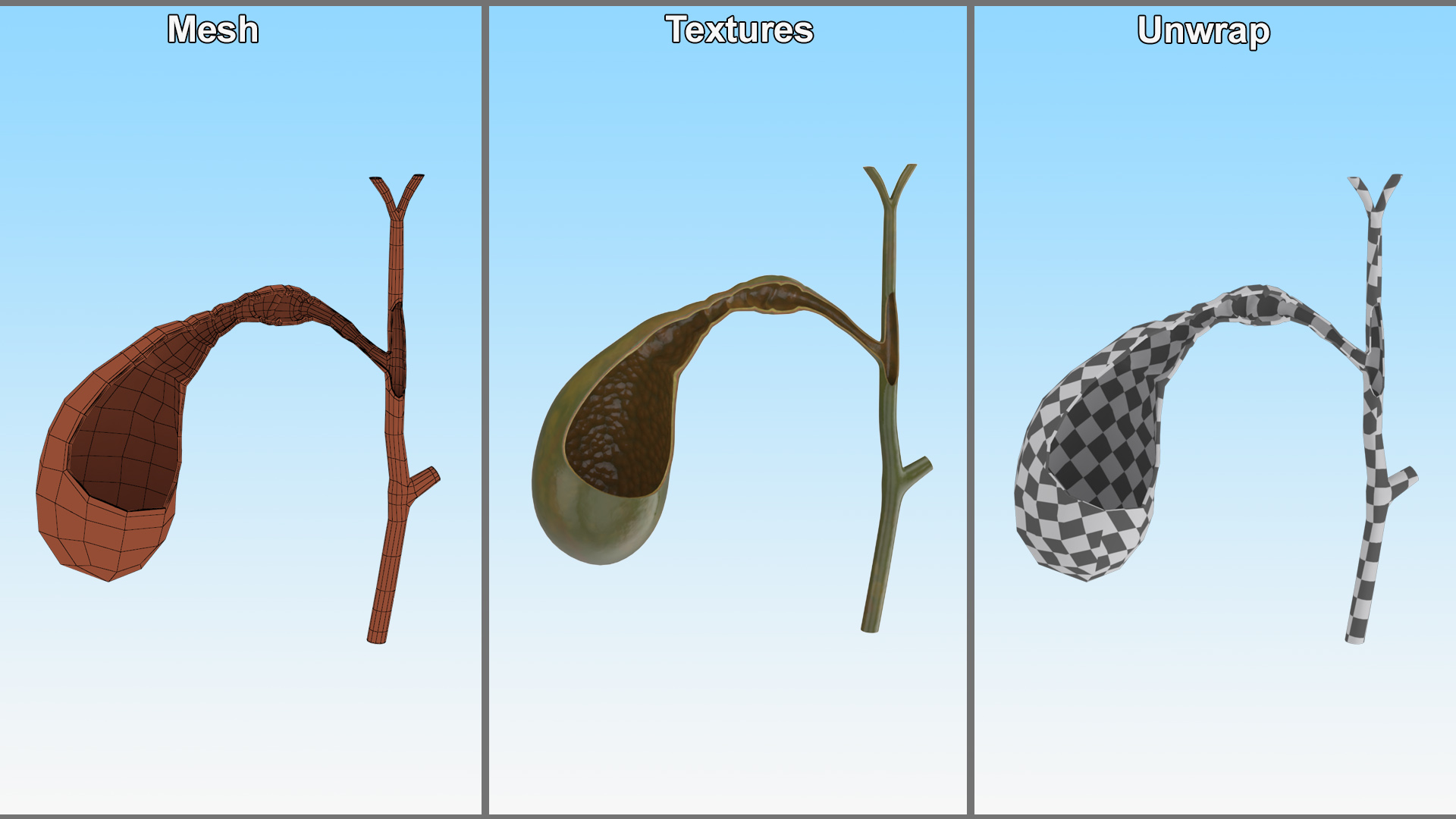 3D Gall Bladder Cut