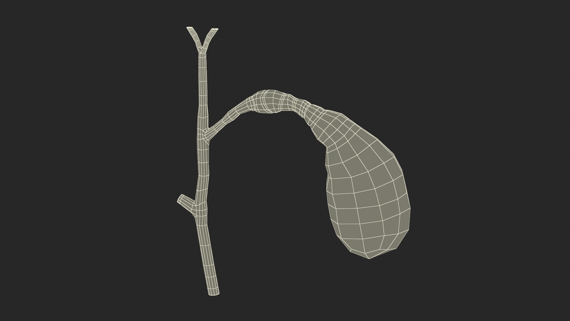 3D Gall Bladder Cut