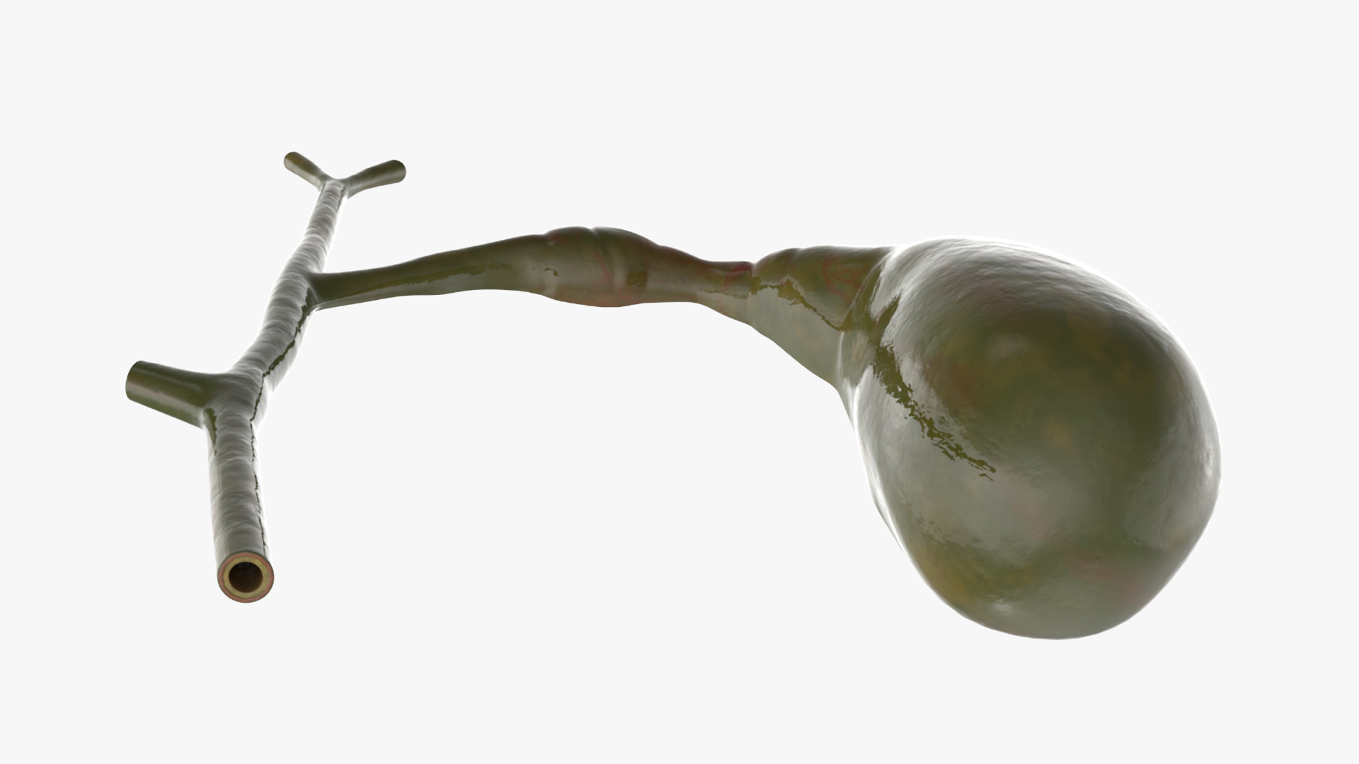 3D Gall Bladder Cut