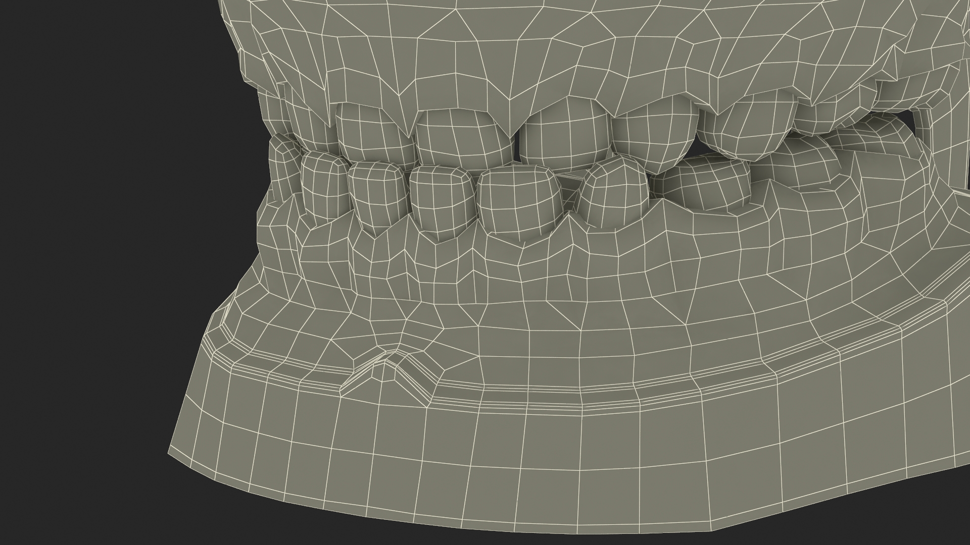 3D Typodont Teaching Studying Model with Removable Underbite Teeth model