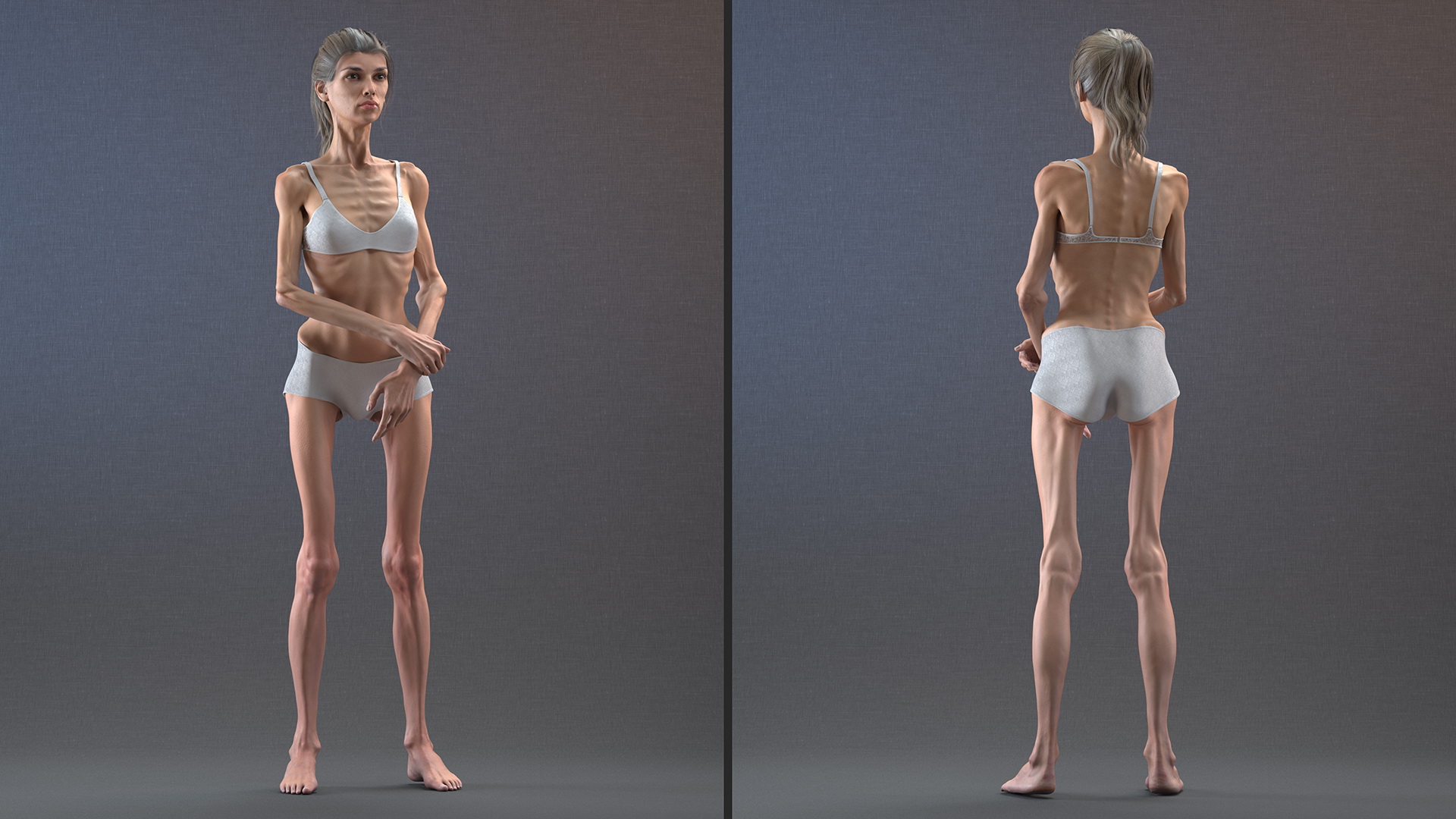 3D Woman Anorexic Rigged