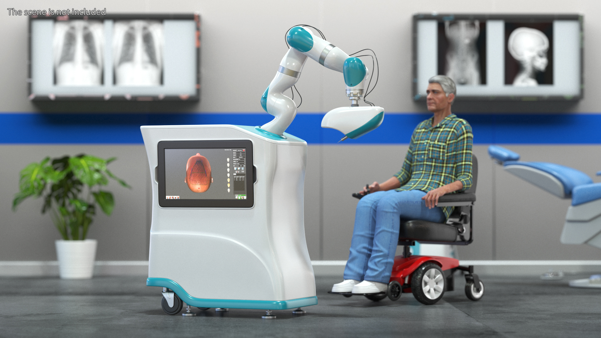 3D Robotic Hair Restoration Rigged