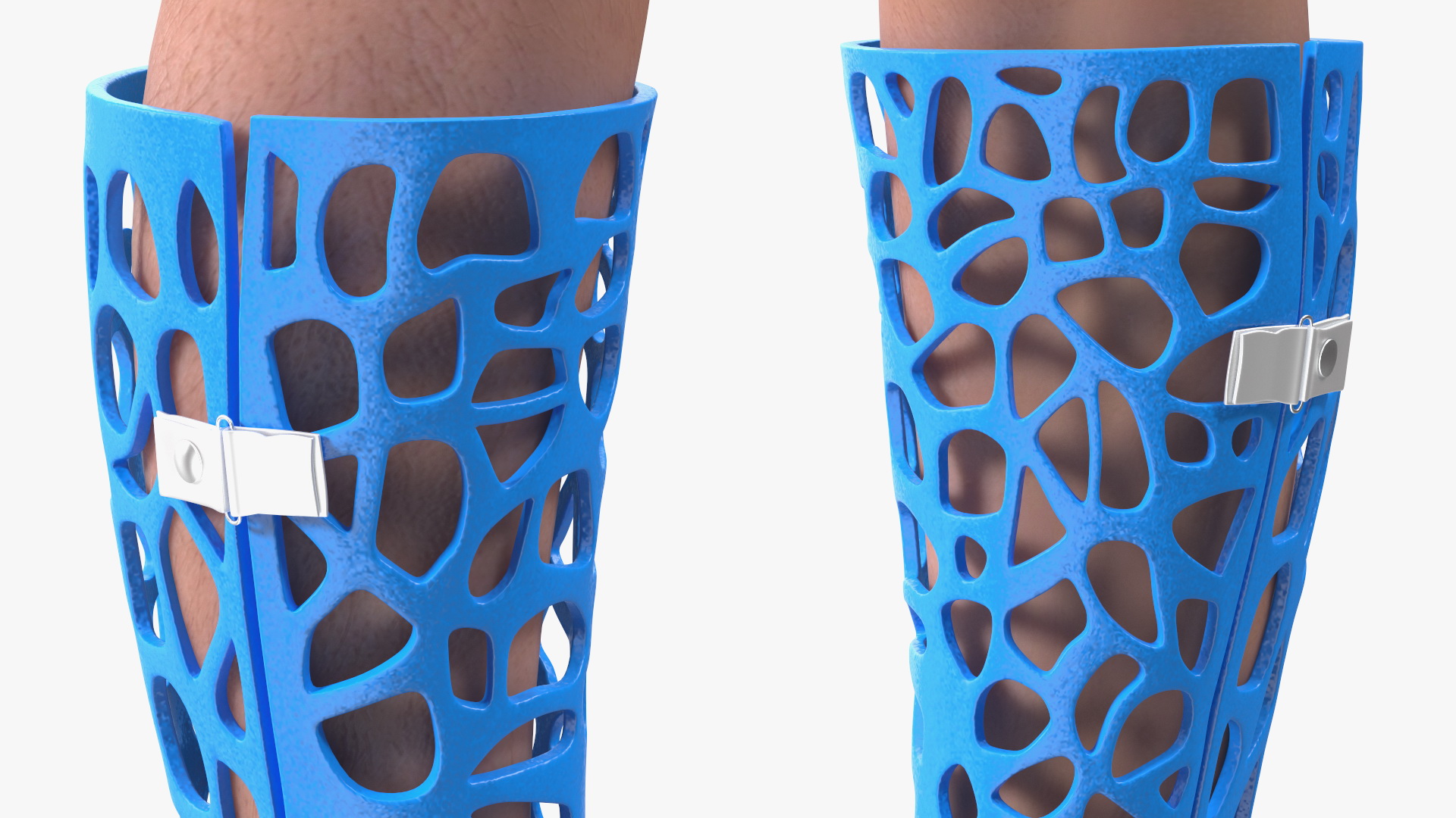 3D 3D-Printed Orthopedic Cast On Leg model