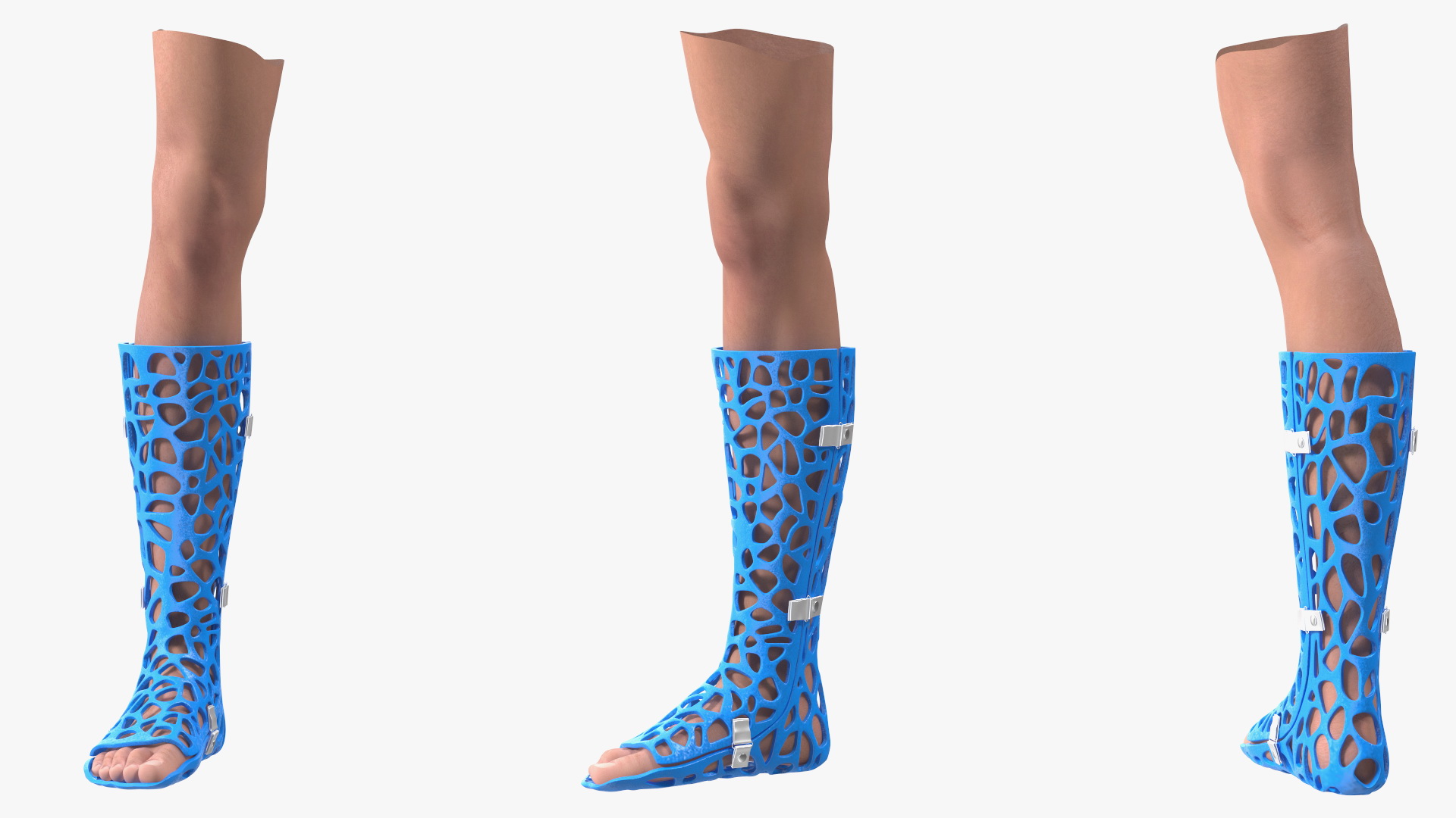 3D 3D-Printed Orthopedic Cast On Leg model