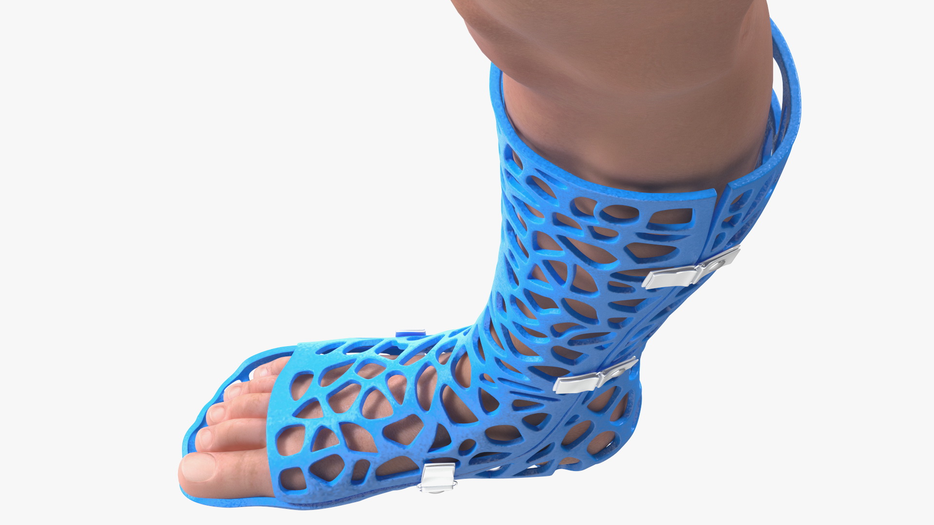 3D 3D-Printed Orthopedic Cast On Leg model