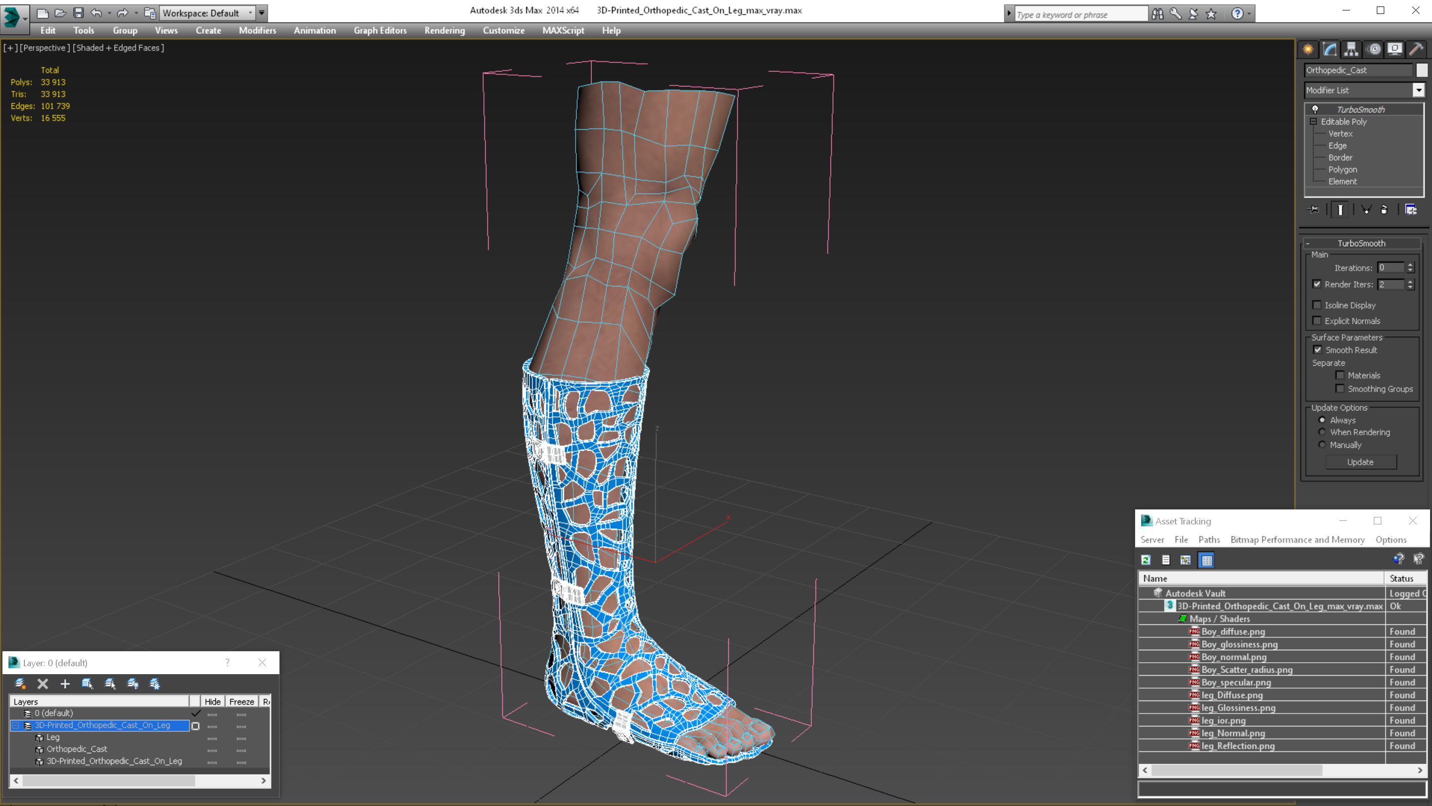 3D 3D-Printed Orthopedic Cast On Leg model
