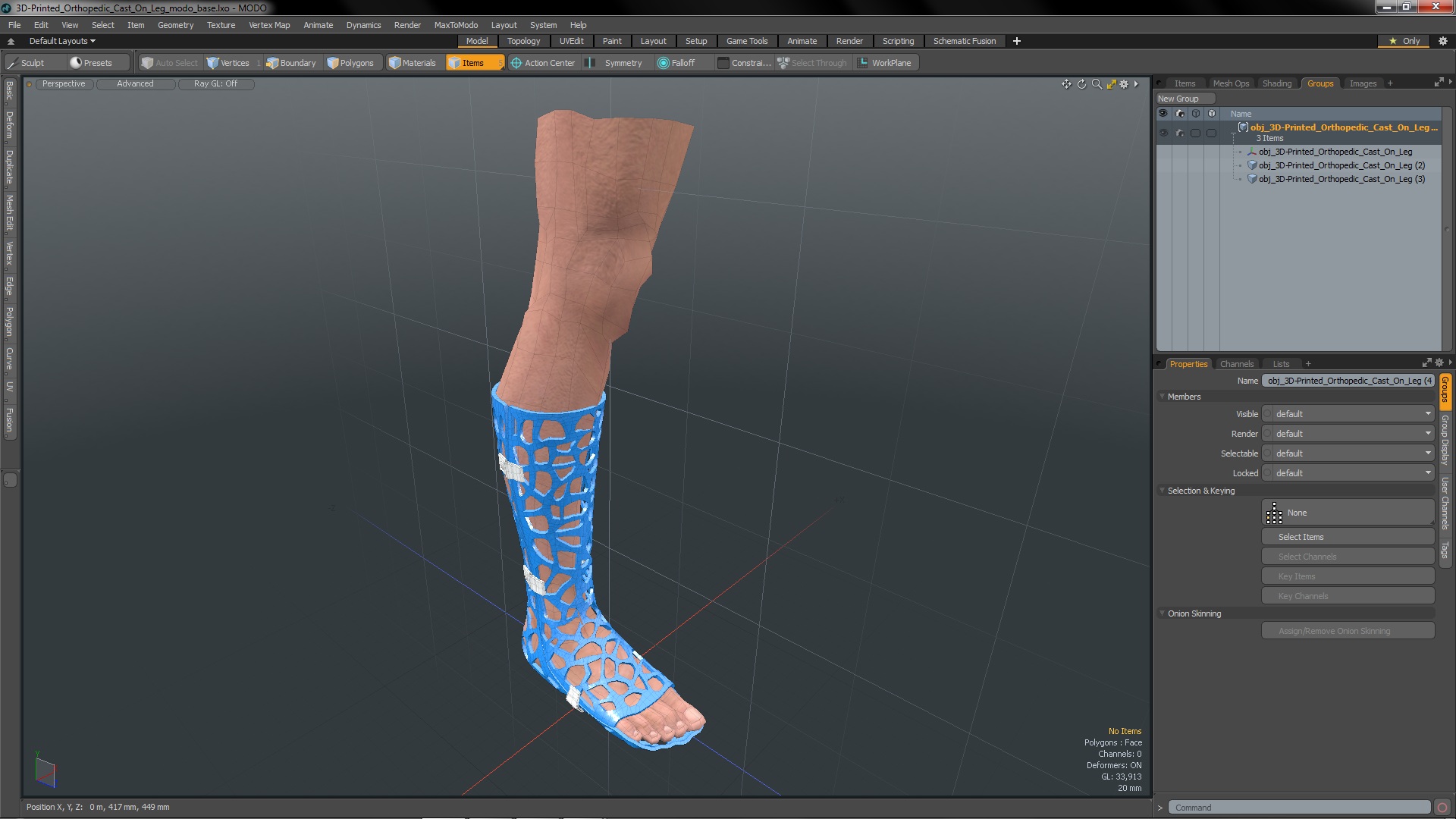 3D 3D-Printed Orthopedic Cast On Leg model