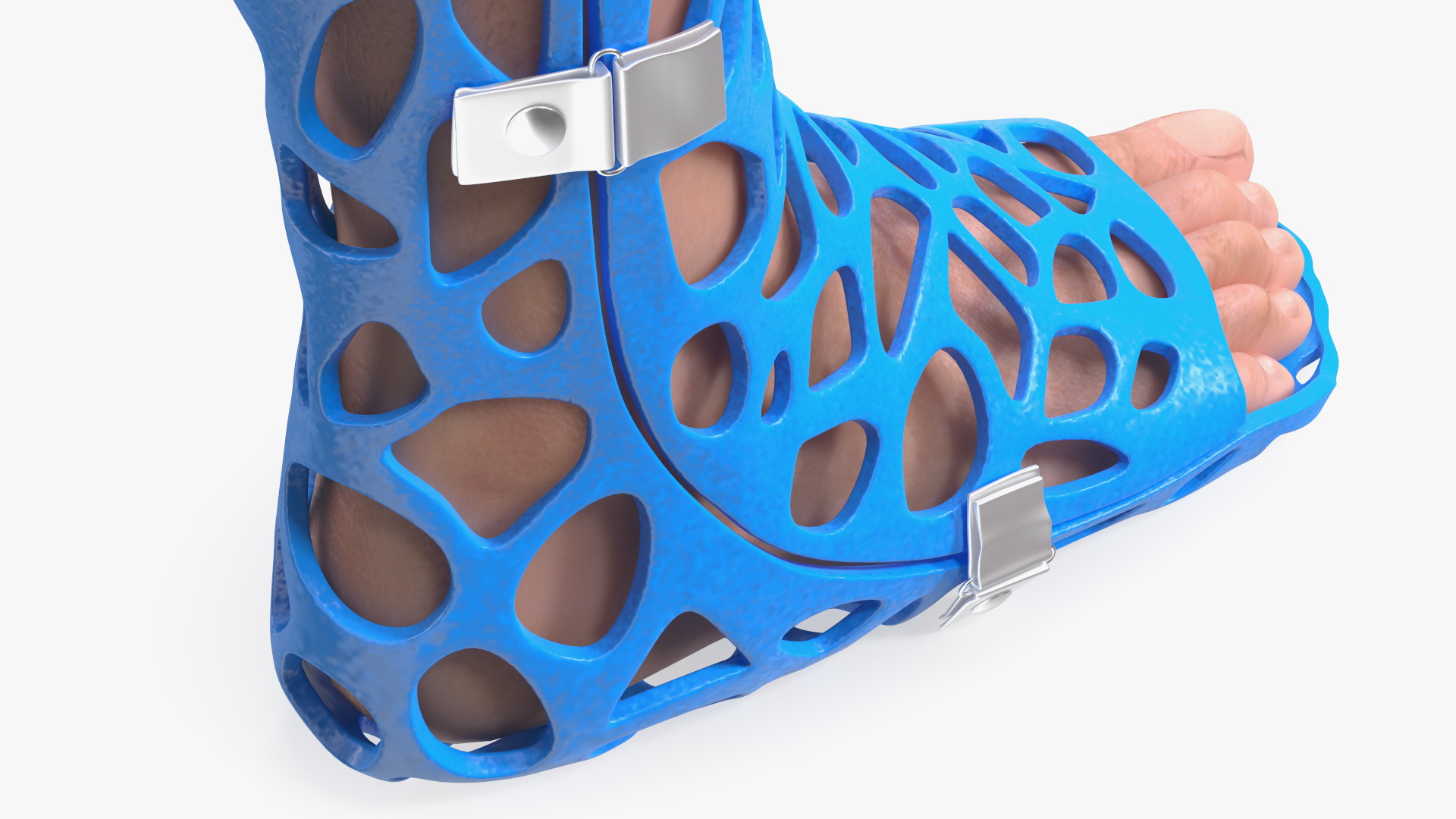 3D 3D-Printed Orthopedic Cast On Leg model