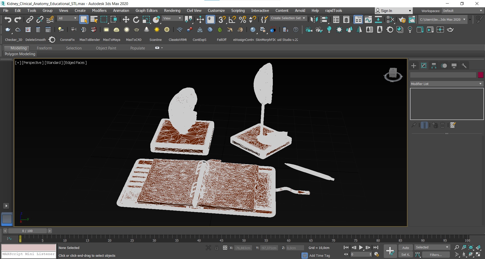 3D Kidney Clinical Anatomy Educational for 3D Print model