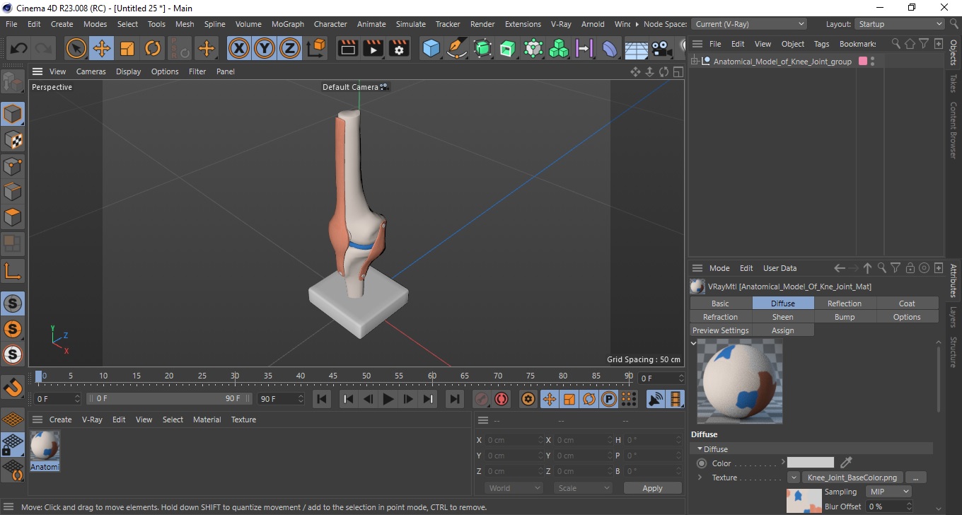 3D Anatomical Model of Knee Joint for 3D Print model