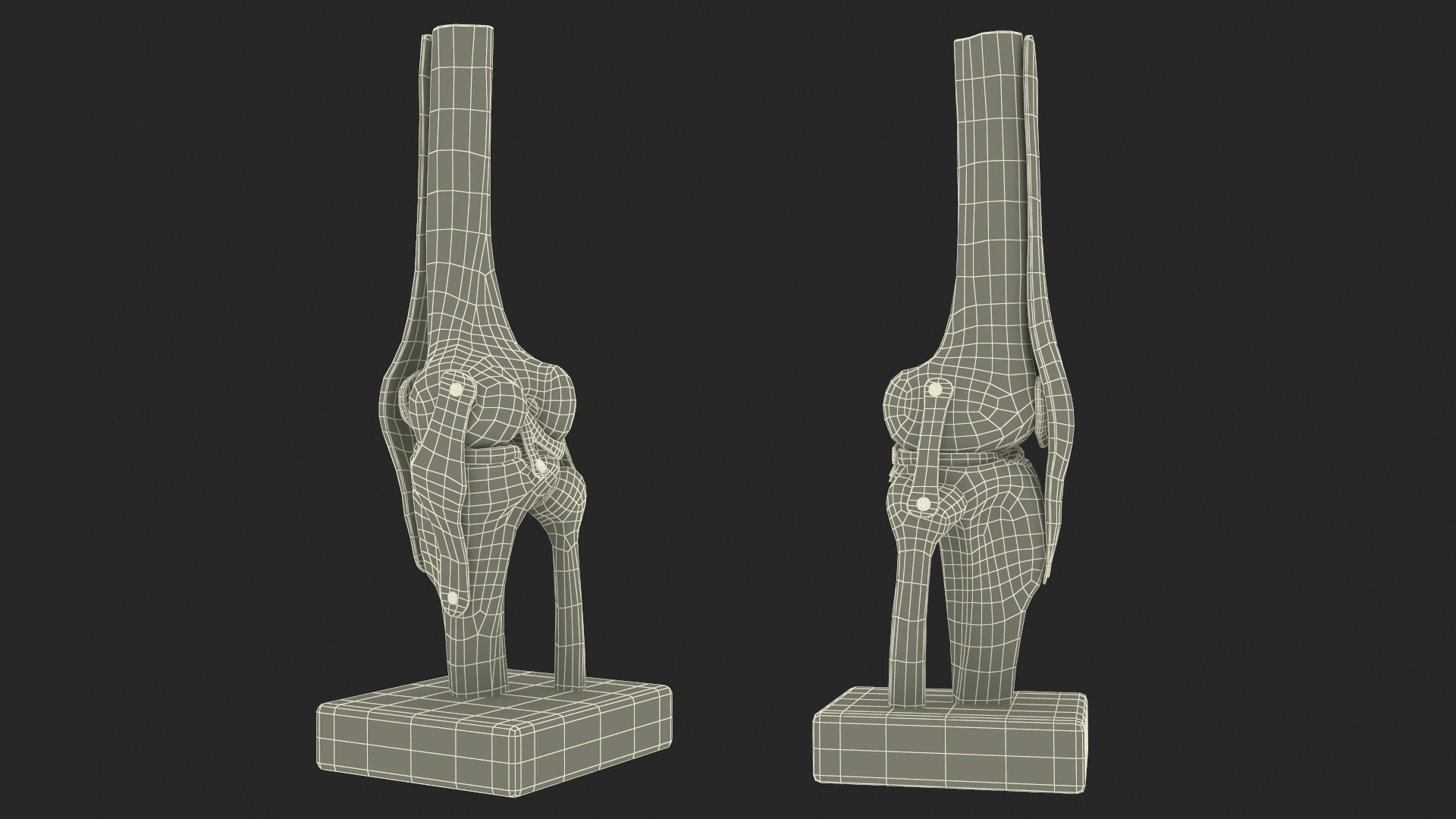 3D Anatomical Model of Knee Joint for 3D Print model