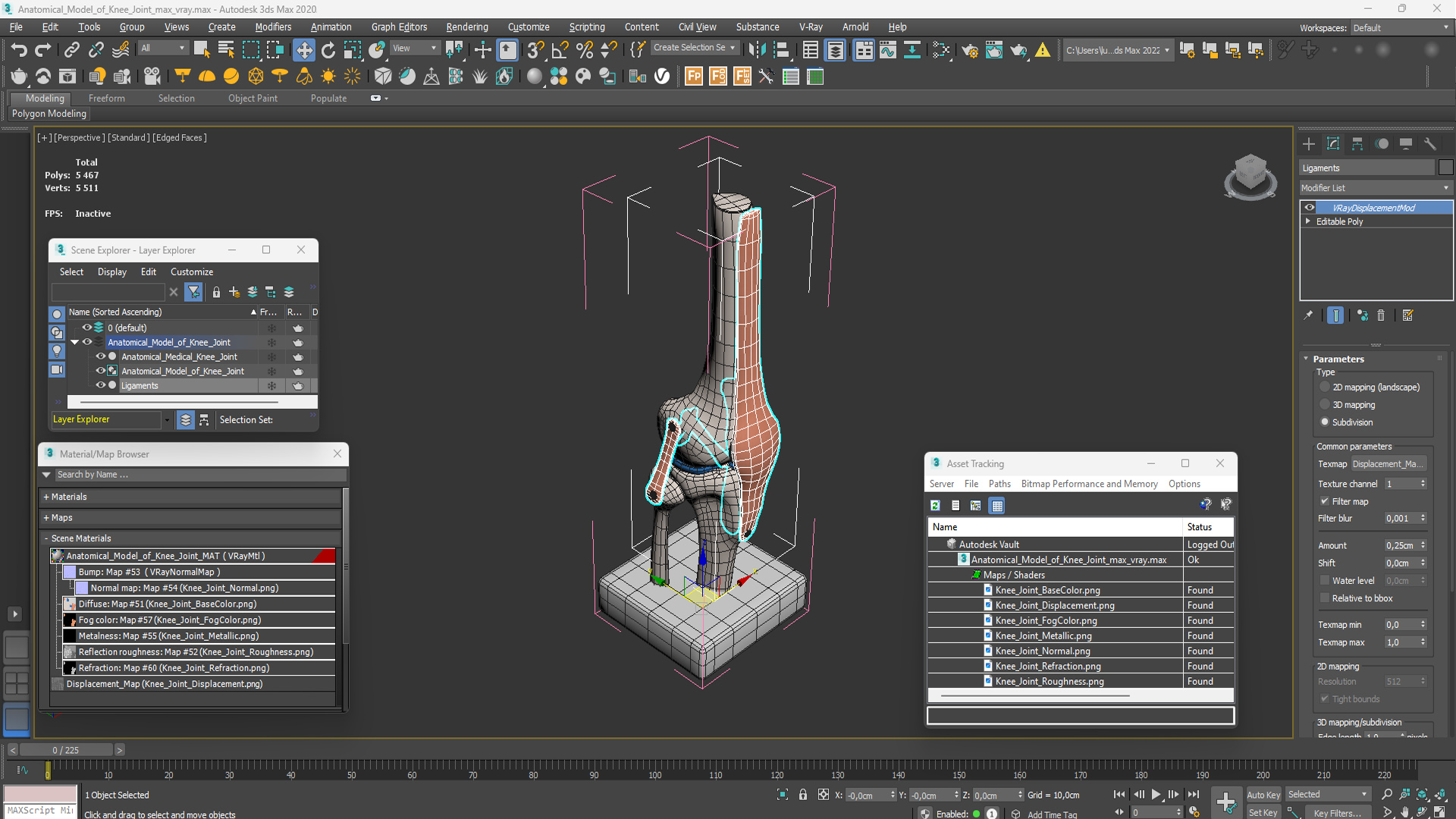 3D Anatomical Model of Knee Joint for 3D Print model