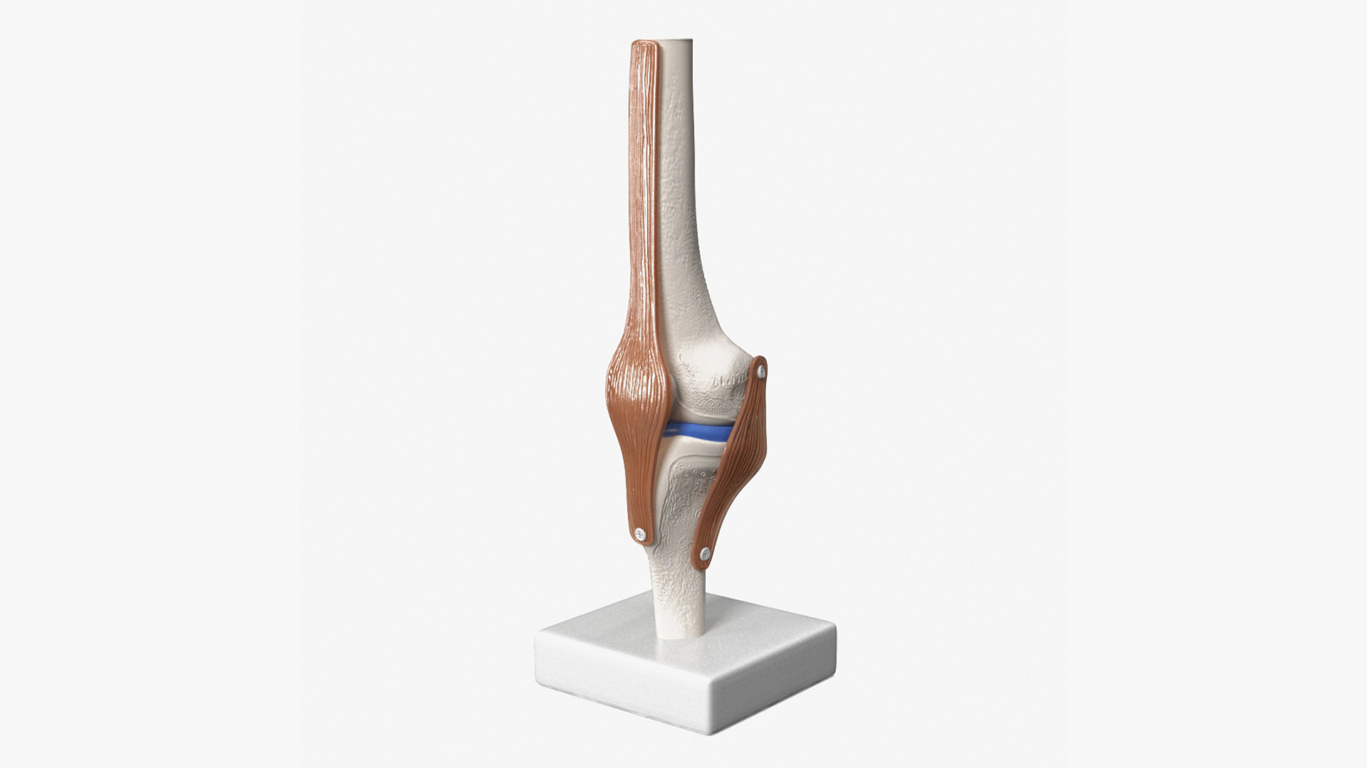 3D Anatomical Model of Knee Joint for 3D Print model