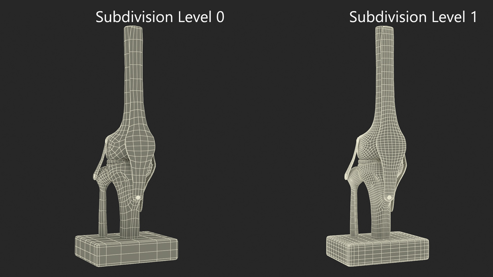 3D Anatomical Model of Knee Joint for 3D Print model