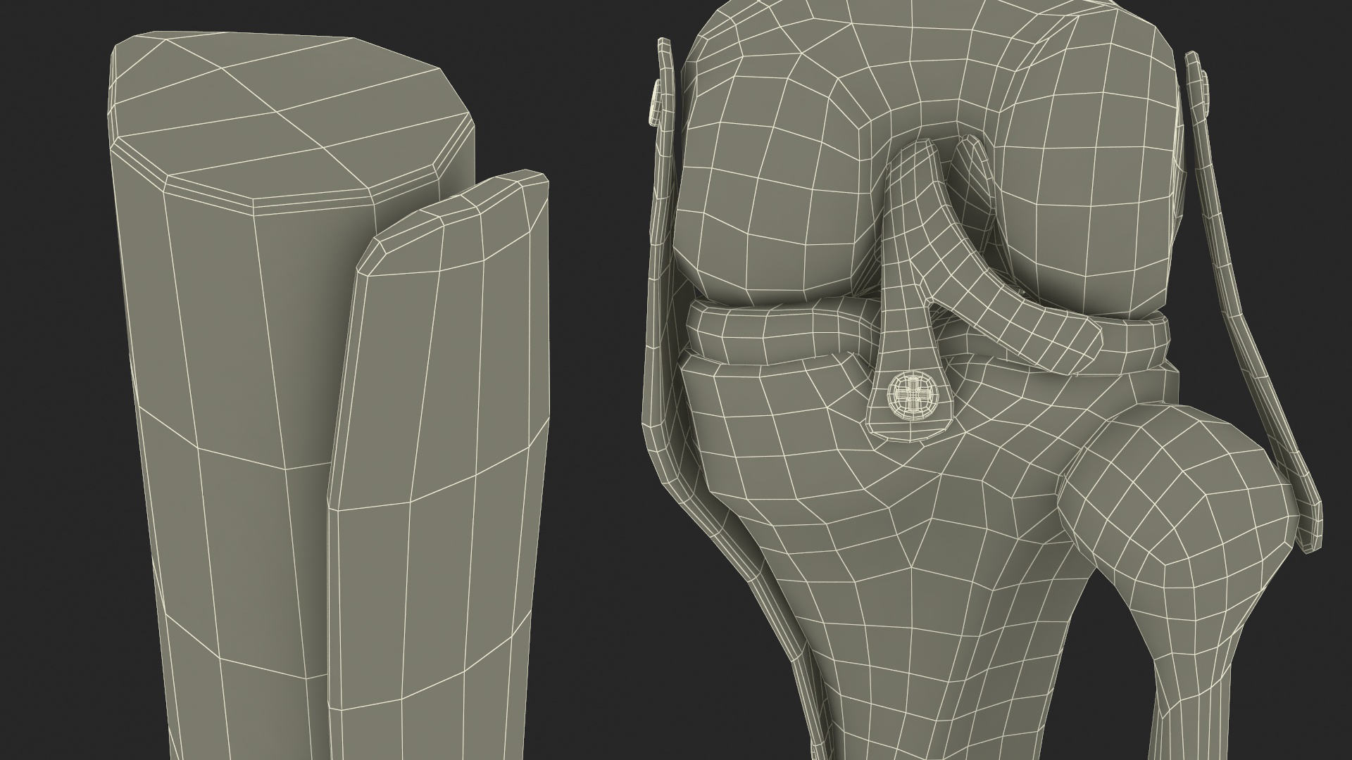 3D Anatomical Model of Knee Joint for 3D Print model