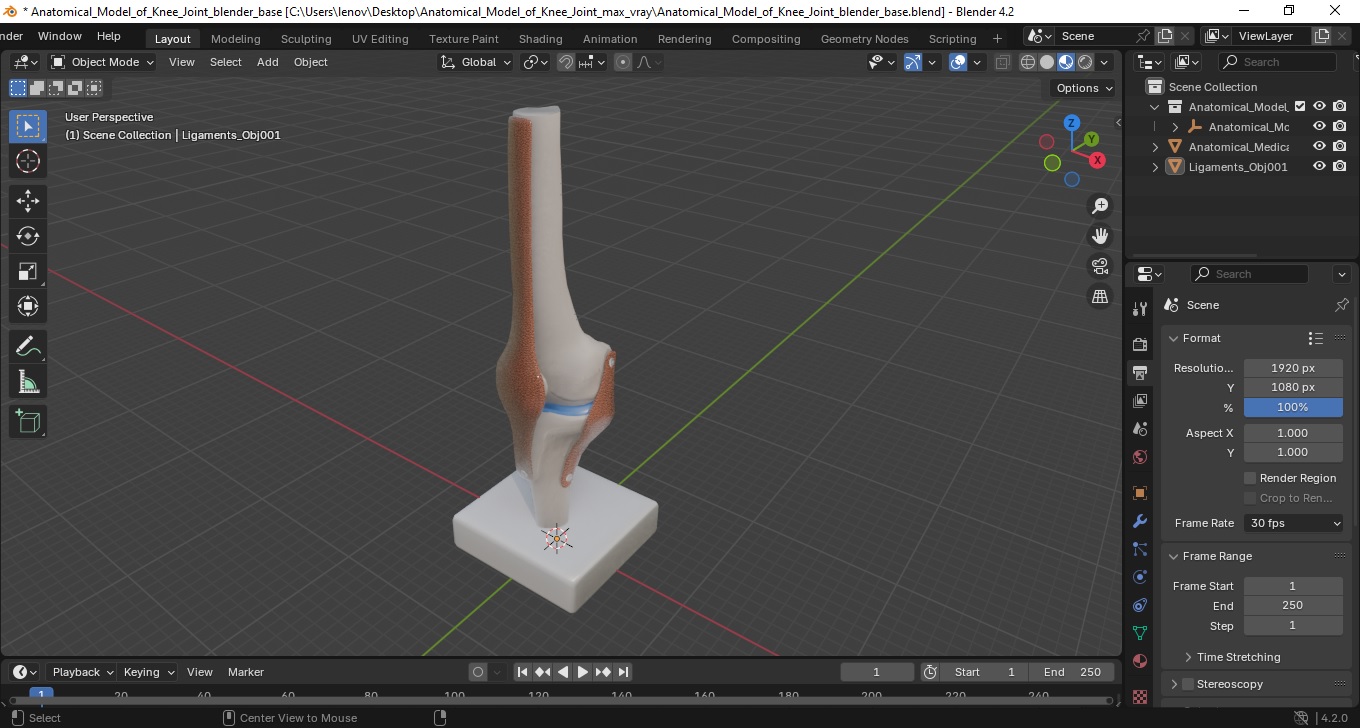 3D Anatomical Model of Knee Joint for 3D Print model