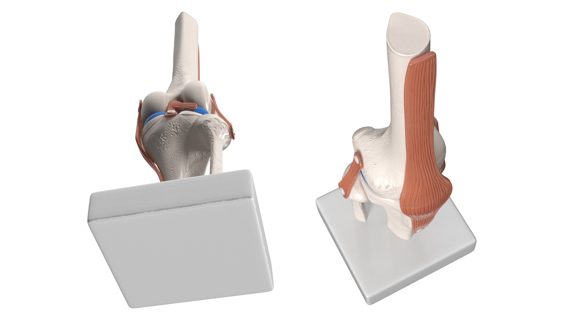 3D Anatomical Model of Knee Joint for 3D Print model