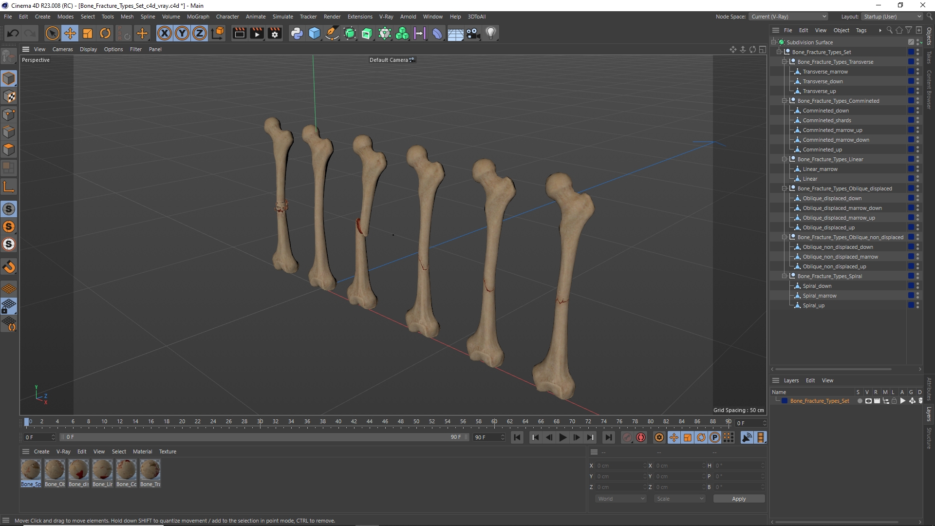 Bone Fracture Types Set - view 12