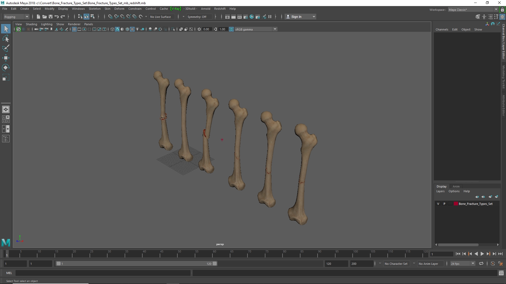 Bone Fracture Types Set - view 11