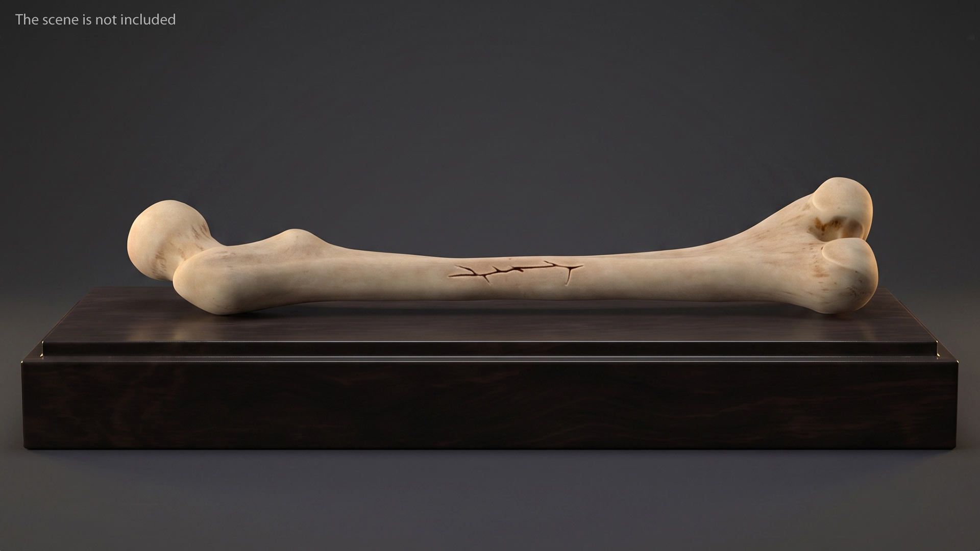 Bone Fracture Types Set - view 3