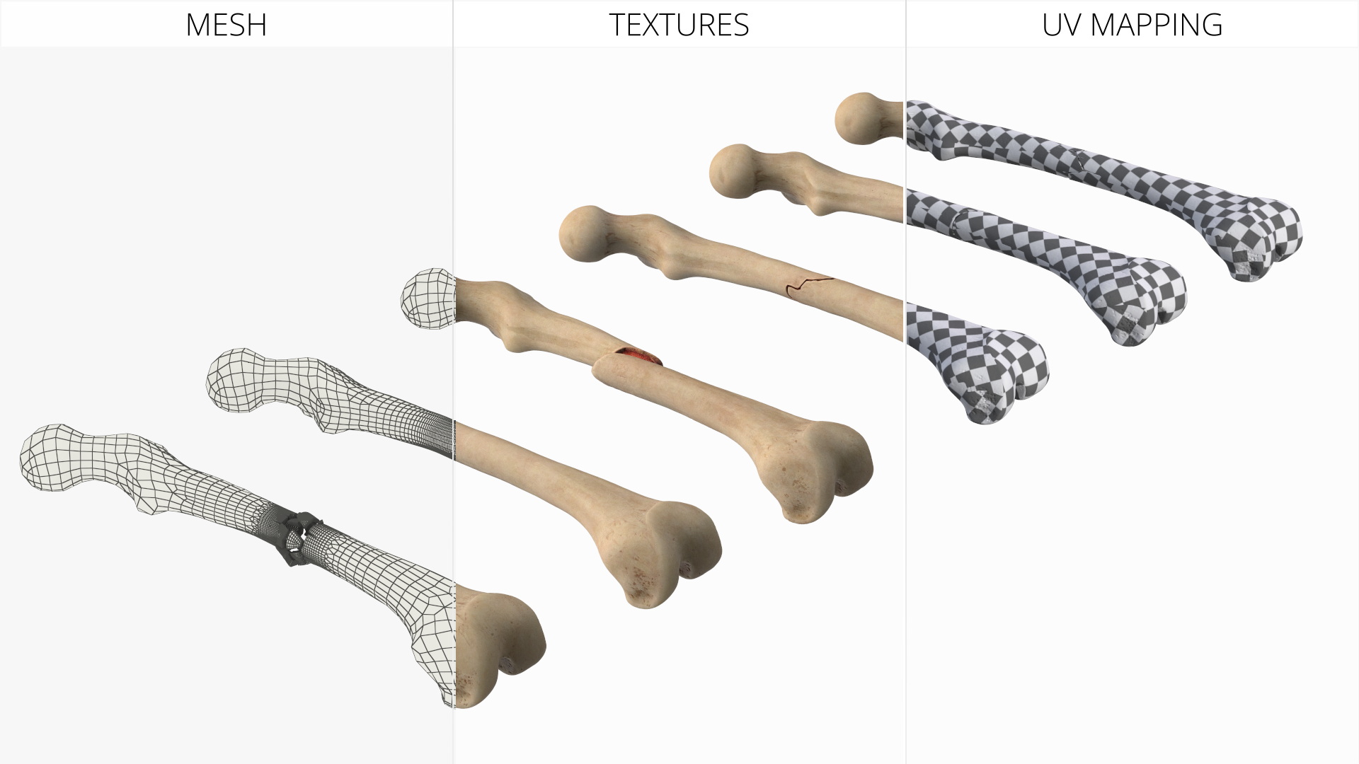 Bone Fracture Types Set - view 9
